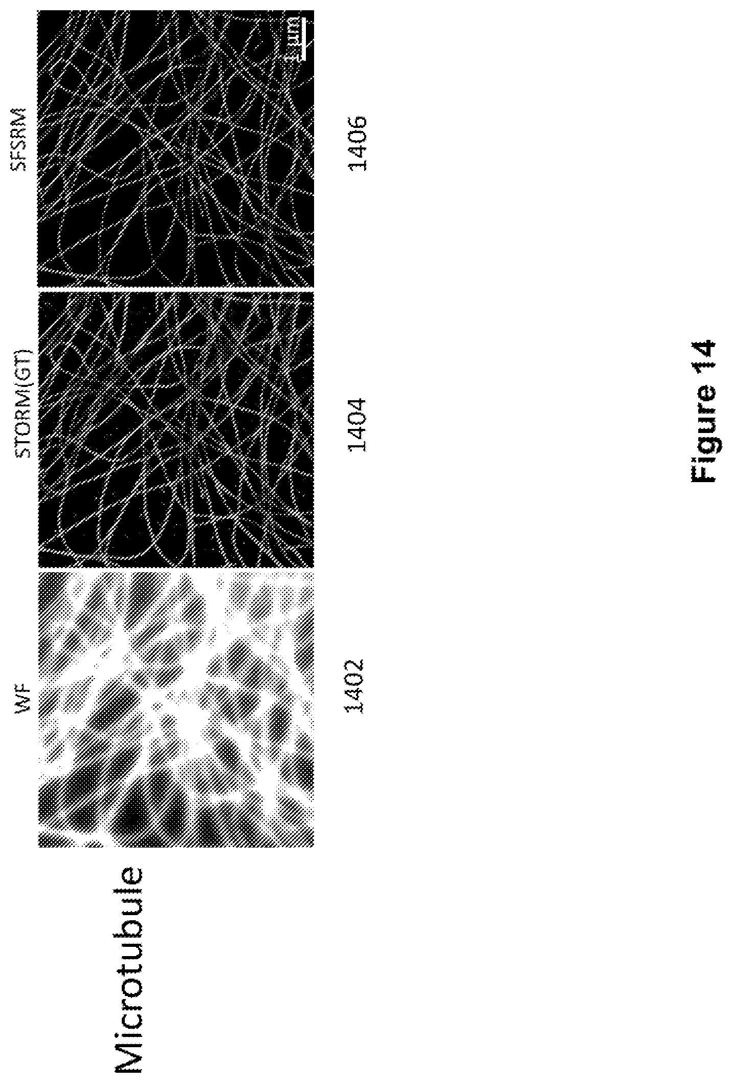 Patent US12327327 Figure 14 – Deep learning based single frame super resolution microscopy image processing