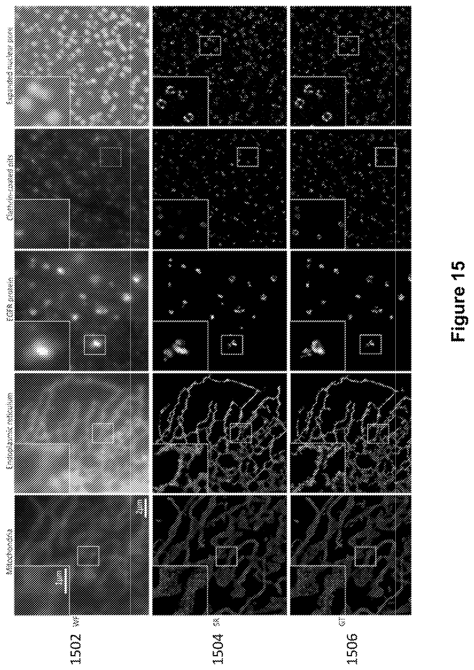 Patent US12327327 Figure 15 – Deep learning based single frame super resolution microscopy image processing