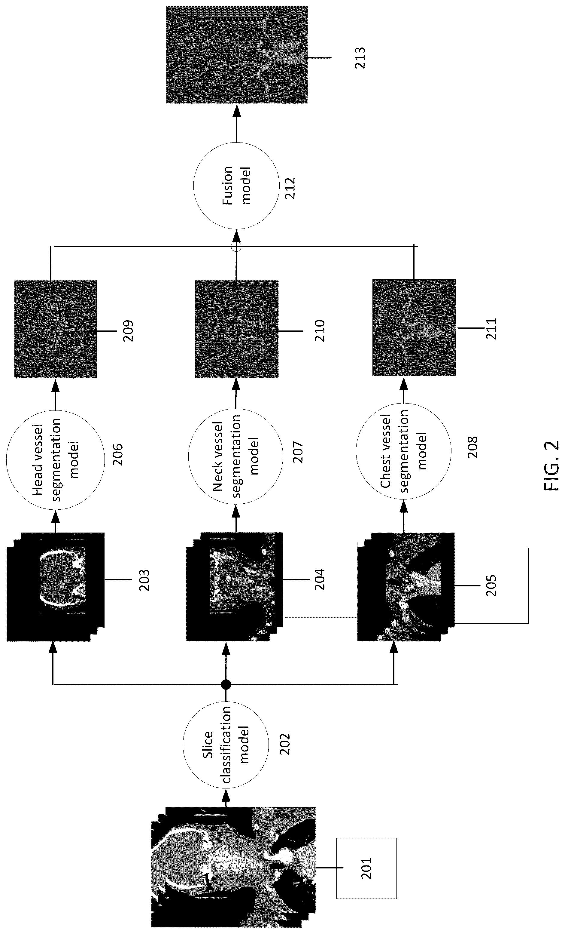 Patent US12327350 Figure 2 – Method and system for performing vessel segmentation in a medical image