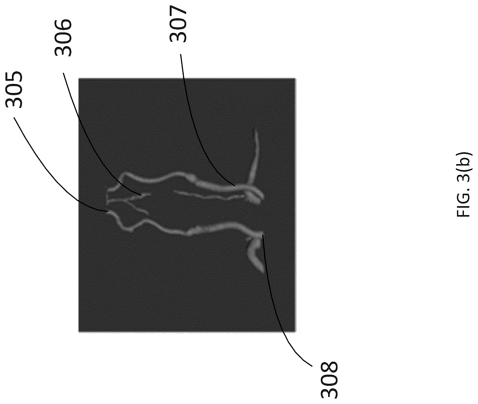 Patent US12327350 Figure 4 – Method and system for performing vessel segmentation in a medical image