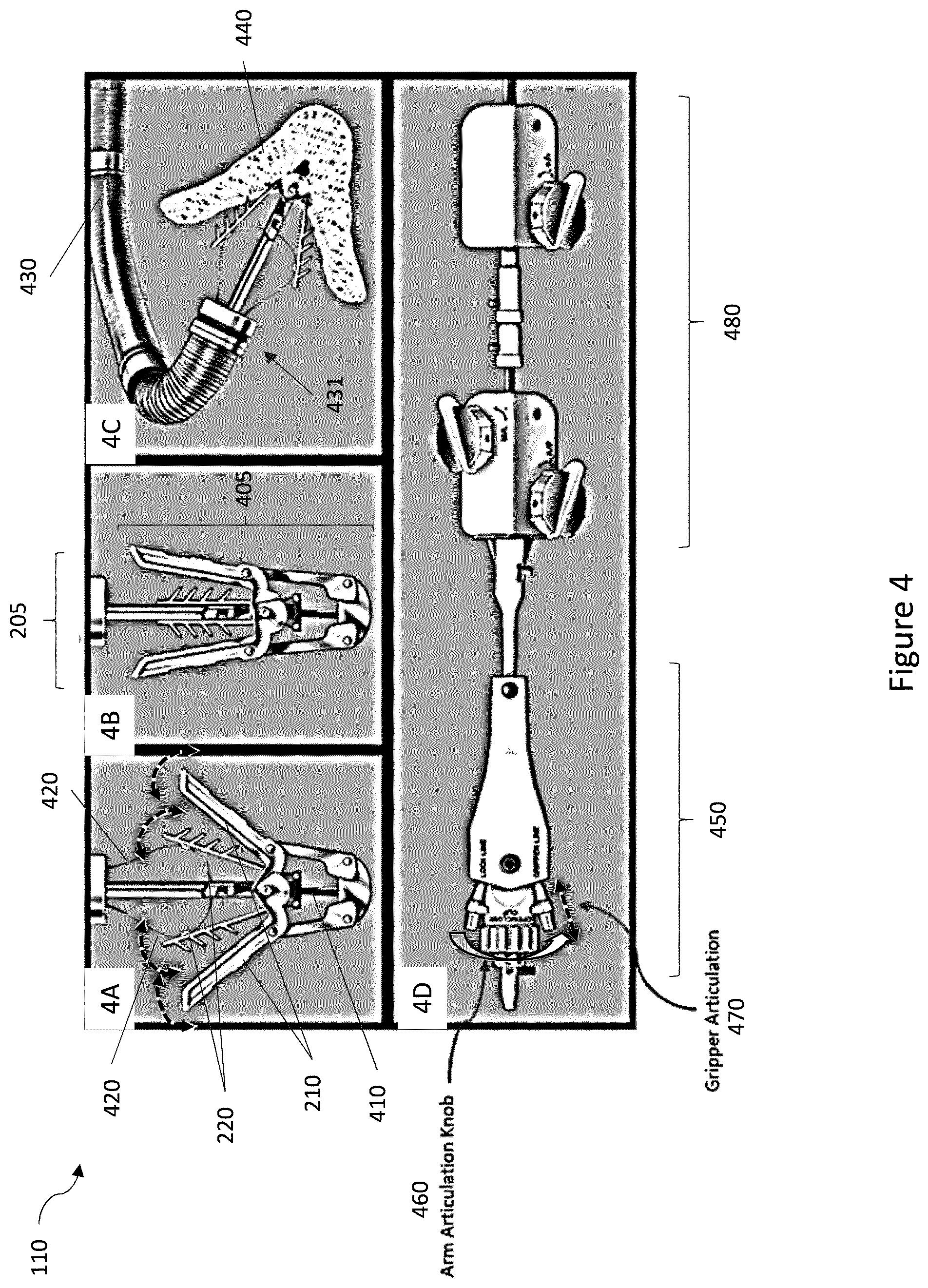 Patent US12327351 Figure 4 – Medical imaging systems, devices, and methods for visualizing a deployment state of an intracorporeal therapeutic device