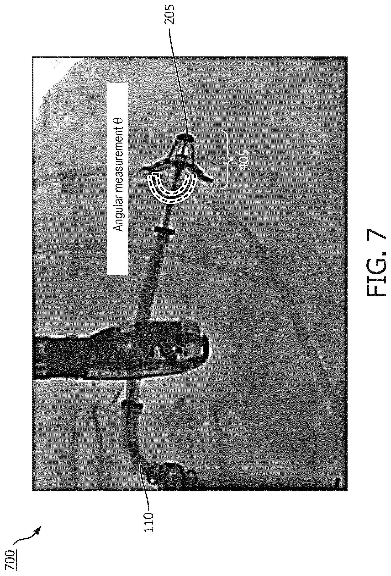 Patent US12327351 Figure 7 – Medical imaging systems, devices, and methods for visualizing a deployment state of an intracorporeal therapeutic device