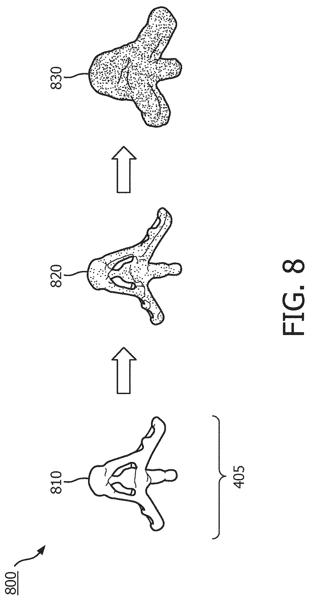 Patent US12327351 Figure 8 – Medical imaging systems, devices, and methods for visualizing a deployment state of an intracorporeal therapeutic device