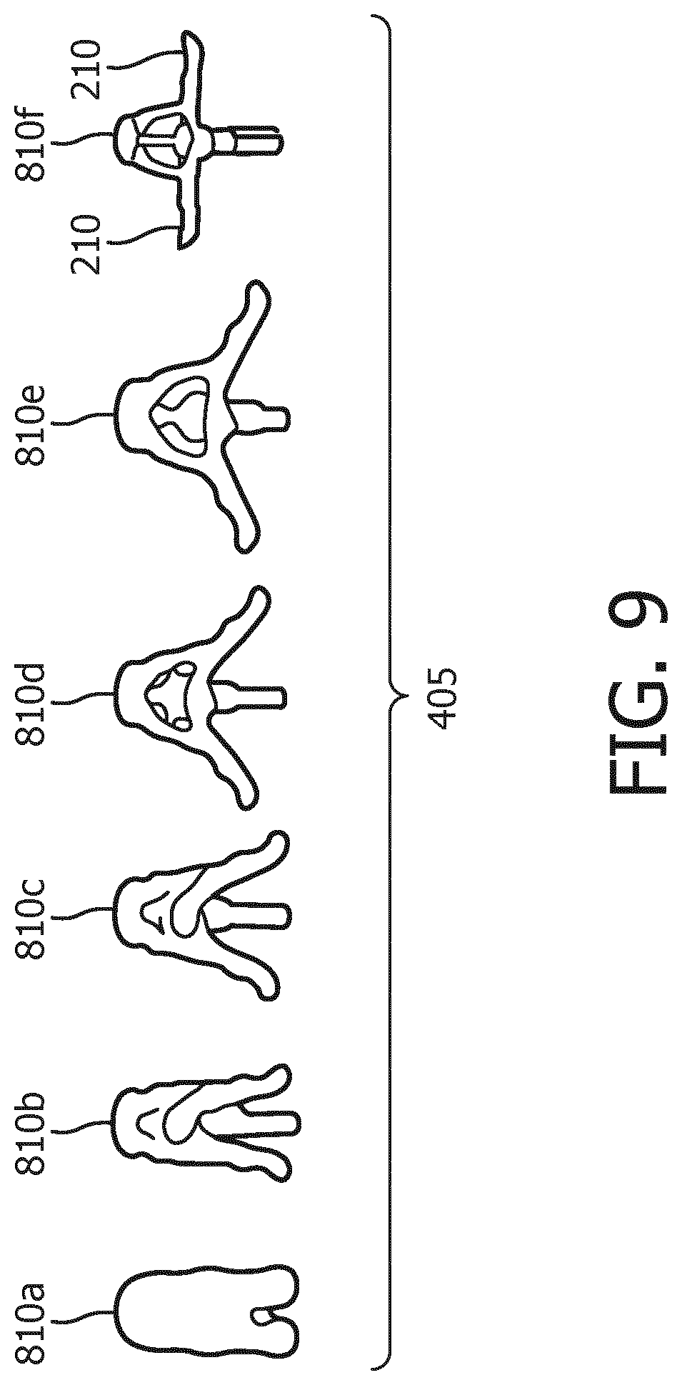 Patent US12327351 Figure 9 – Medical imaging systems, devices, and methods for visualizing a deployment state of an intracorporeal therapeutic device