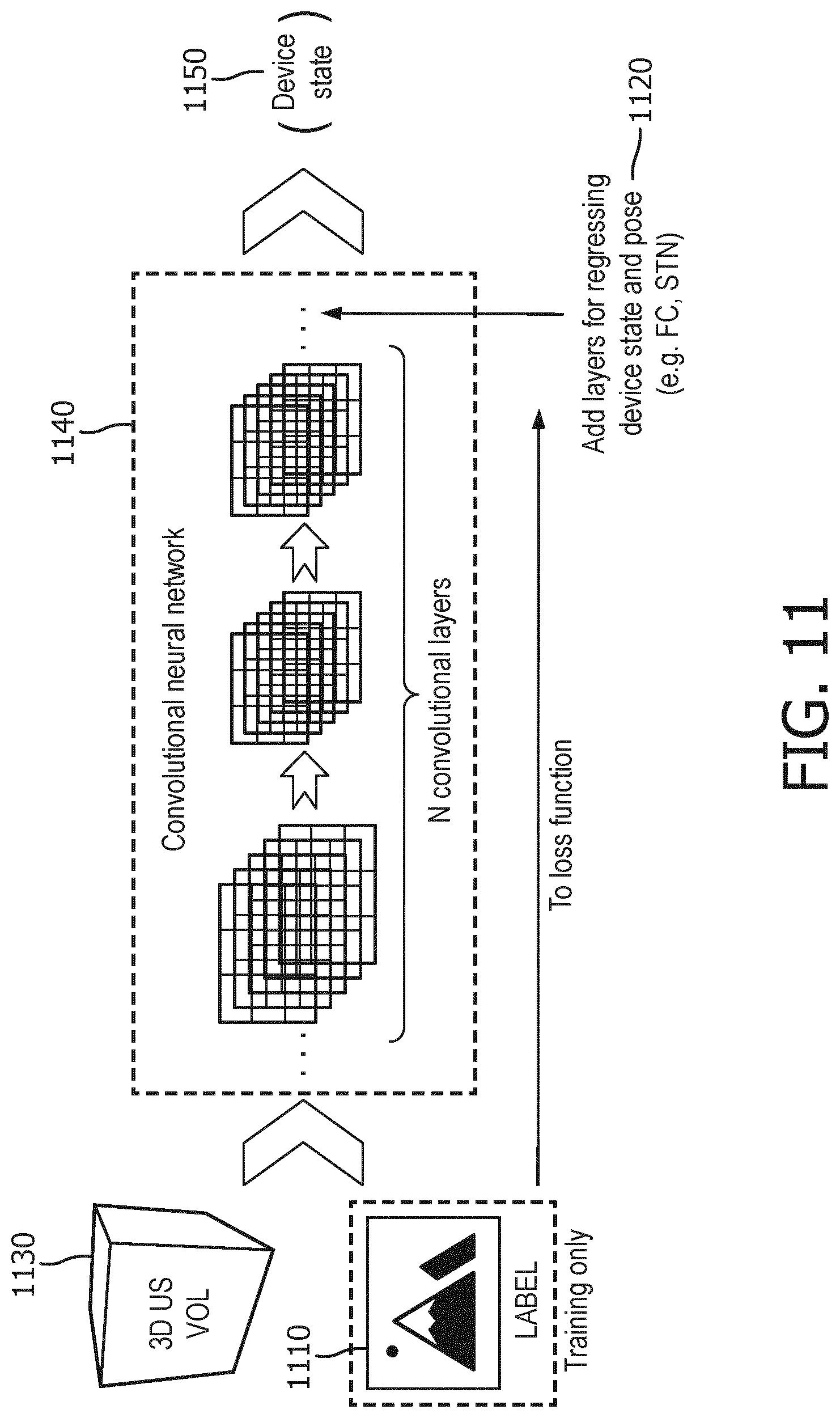 Patent US12327351 Figure 11 – Medical imaging systems, devices, and methods for visualizing a deployment state of an intracorporeal therapeutic device
