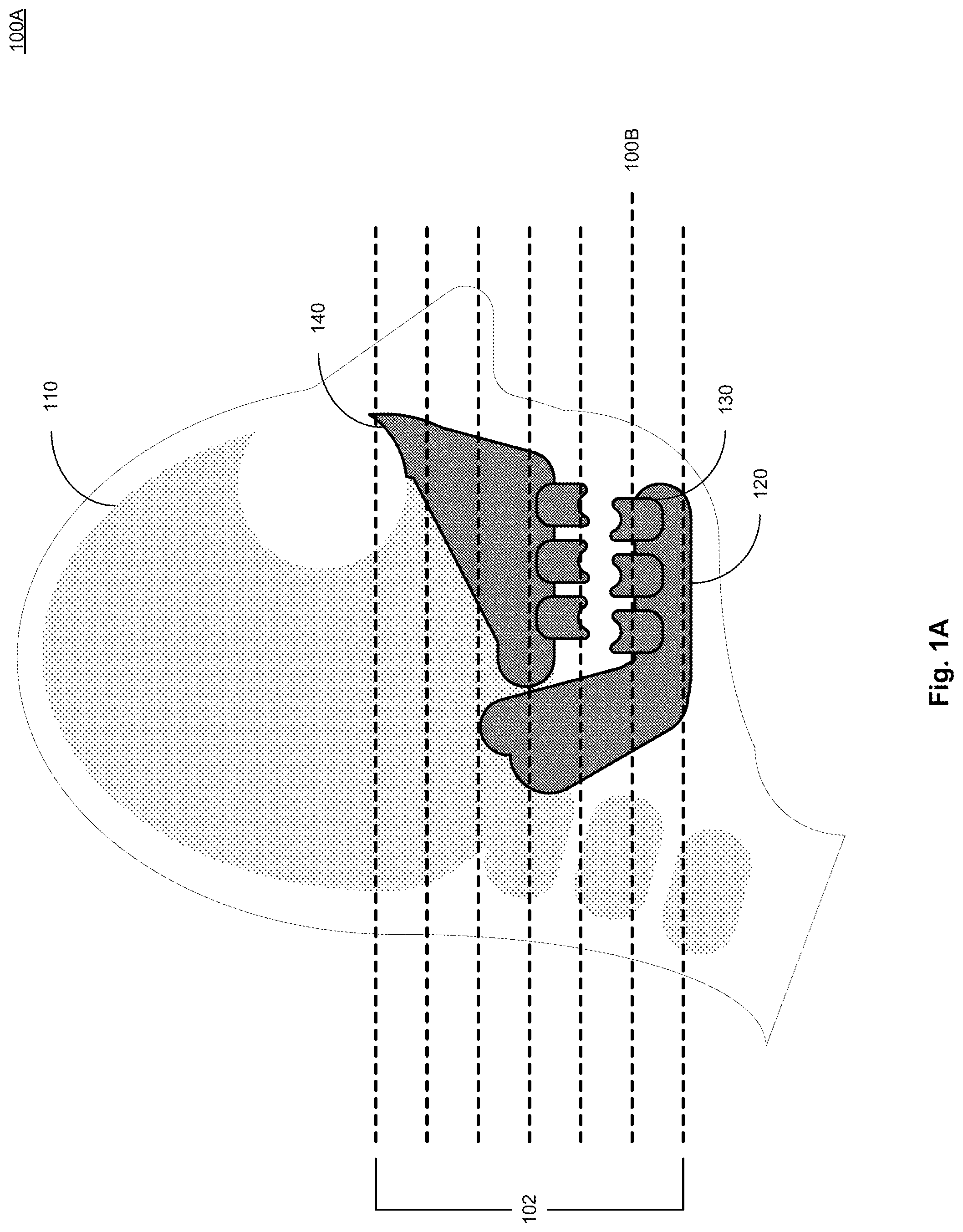 Patent US12327355 — System and method for generating a diagnostic model and user interface presentation based on individual anatomical features — Figure 1