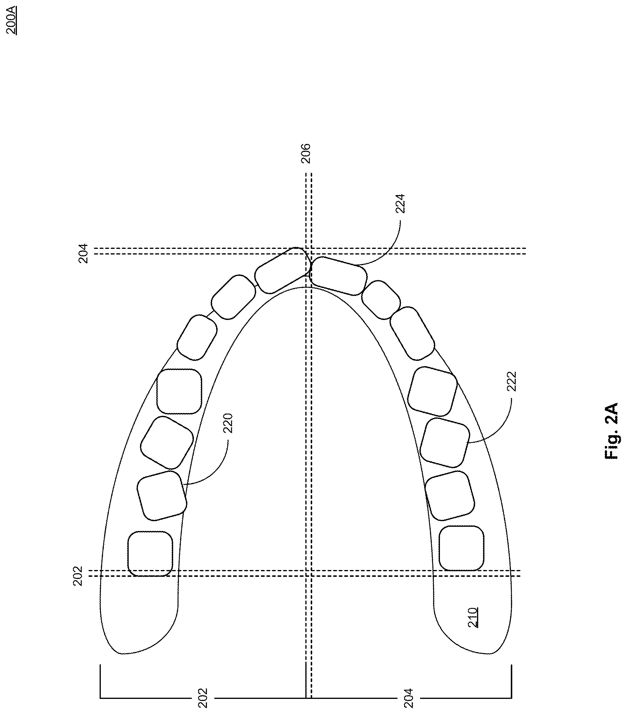 Patent US12327355 Figure 3 – System and method for generating a diagnostic model and user interface presentation based on individual anatomical features