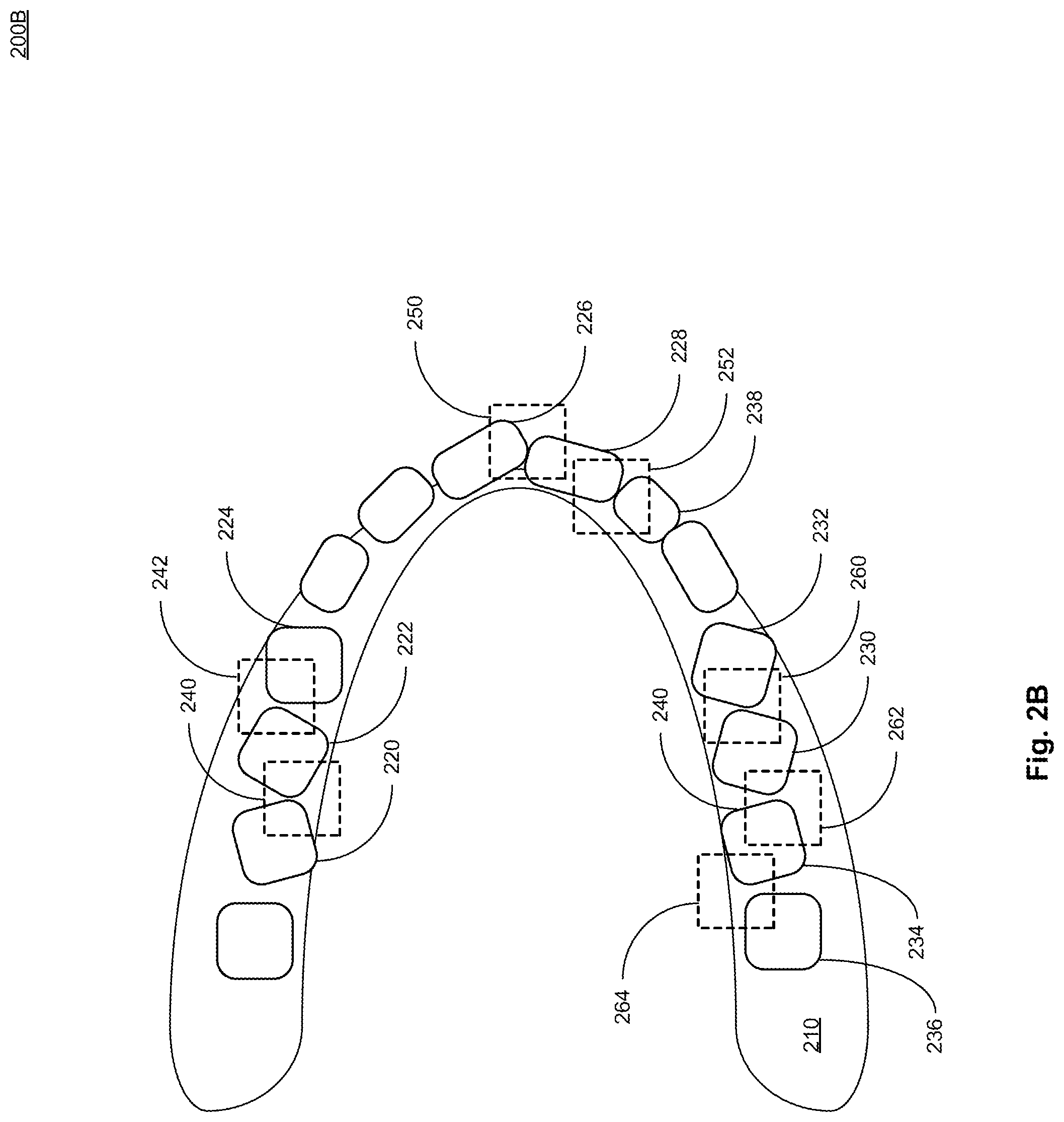 Patent US12327355 Figure 4 – System and method for generating a diagnostic model and user interface presentation based on individual anatomical features