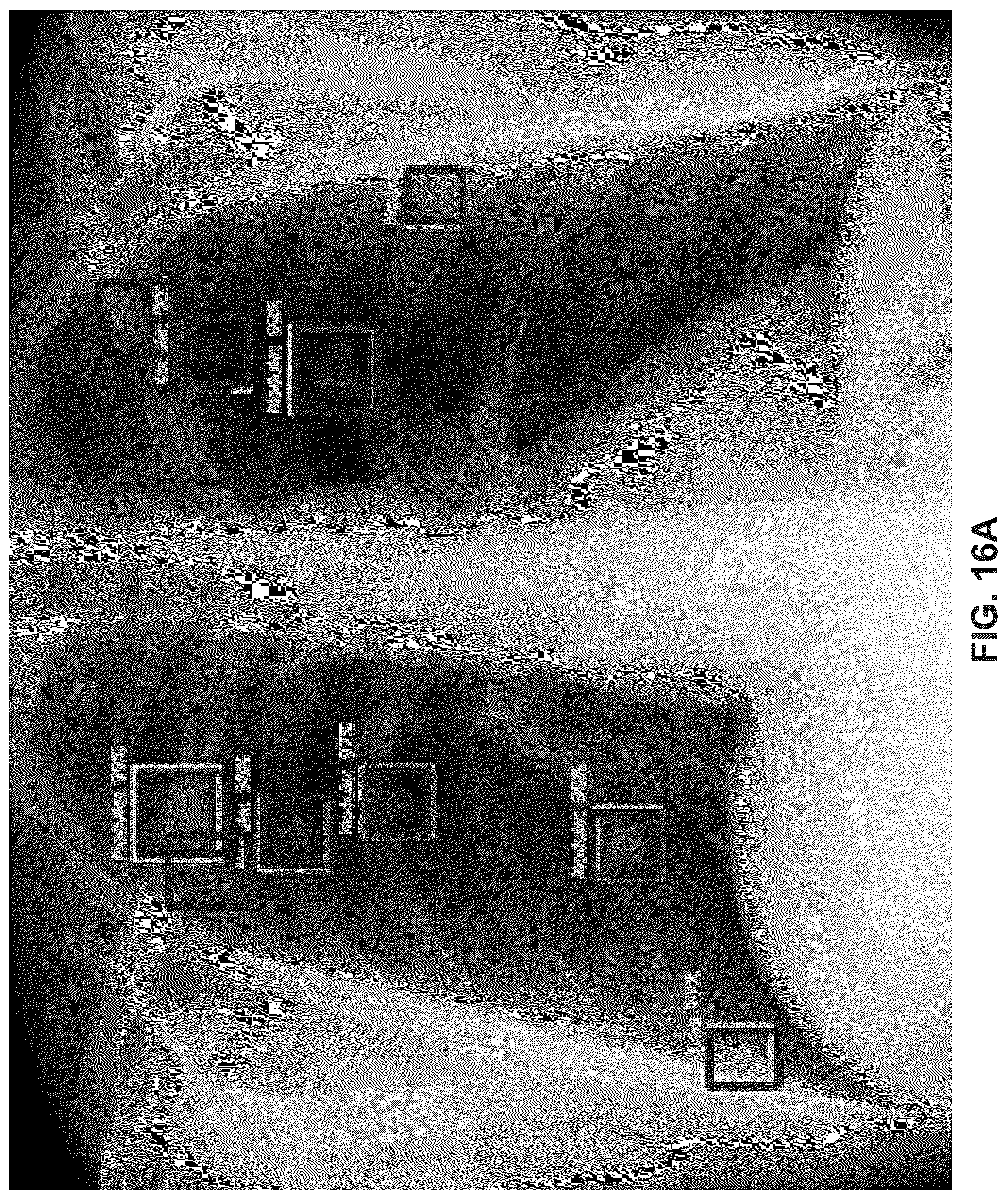 Patent US12327356 Figure 20 – Methods of assessing lung disease in chest X-rays