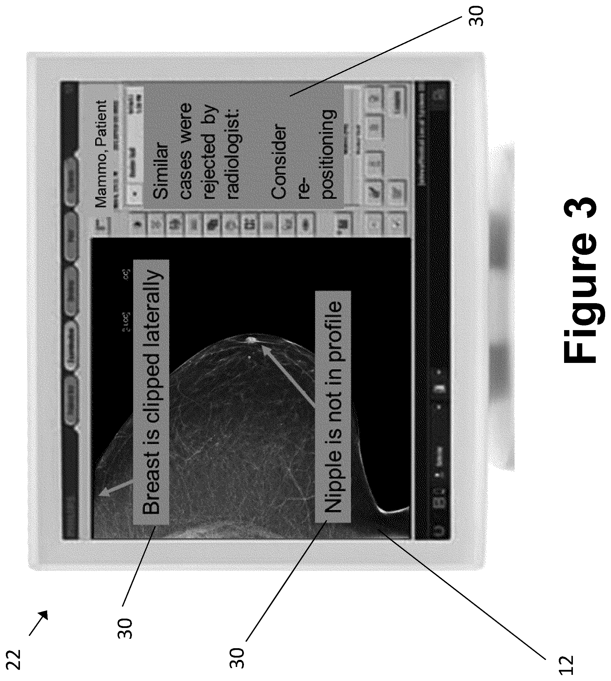 Patent US12327357 Figure 3 – Systems and methods for immediate image quality feedback