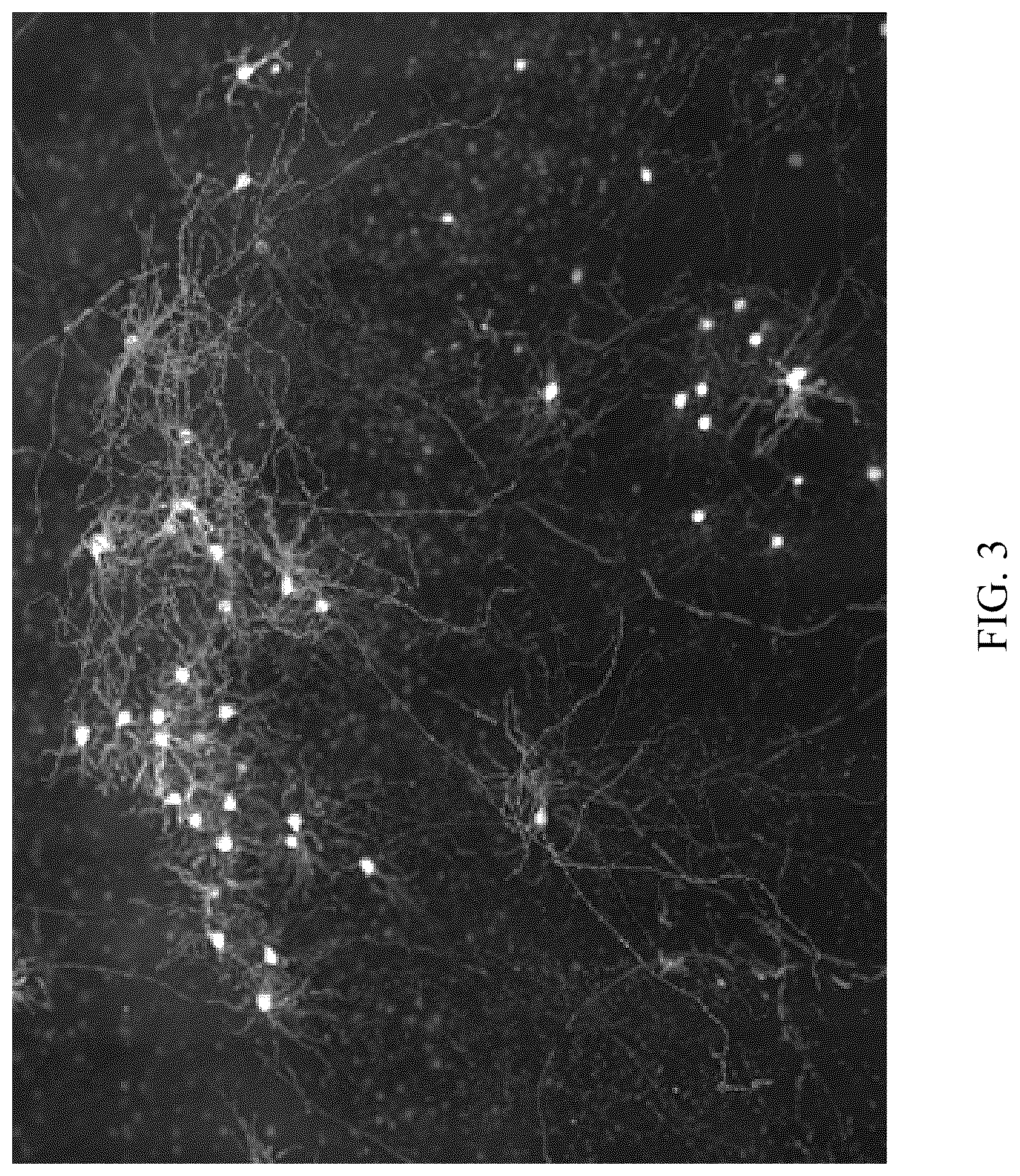 Patent US12327358 Figure 3 – Method for reconstructing dendritic tissue in image, device and storage medium