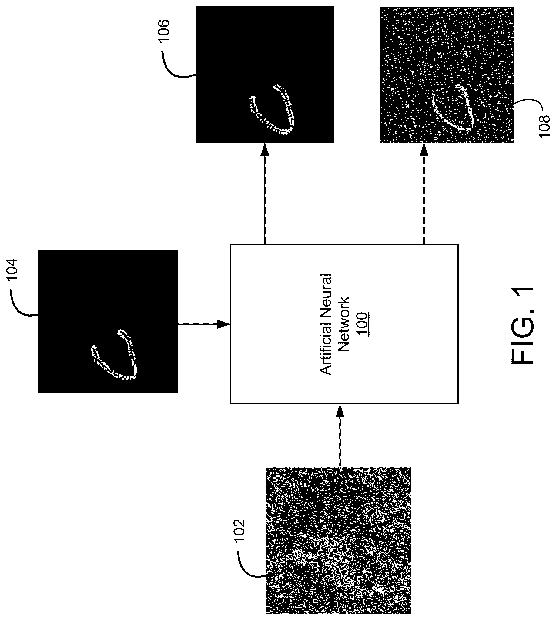Patent US12327359 Figure 1 – Image segmentation and tracking based on statistical shape model