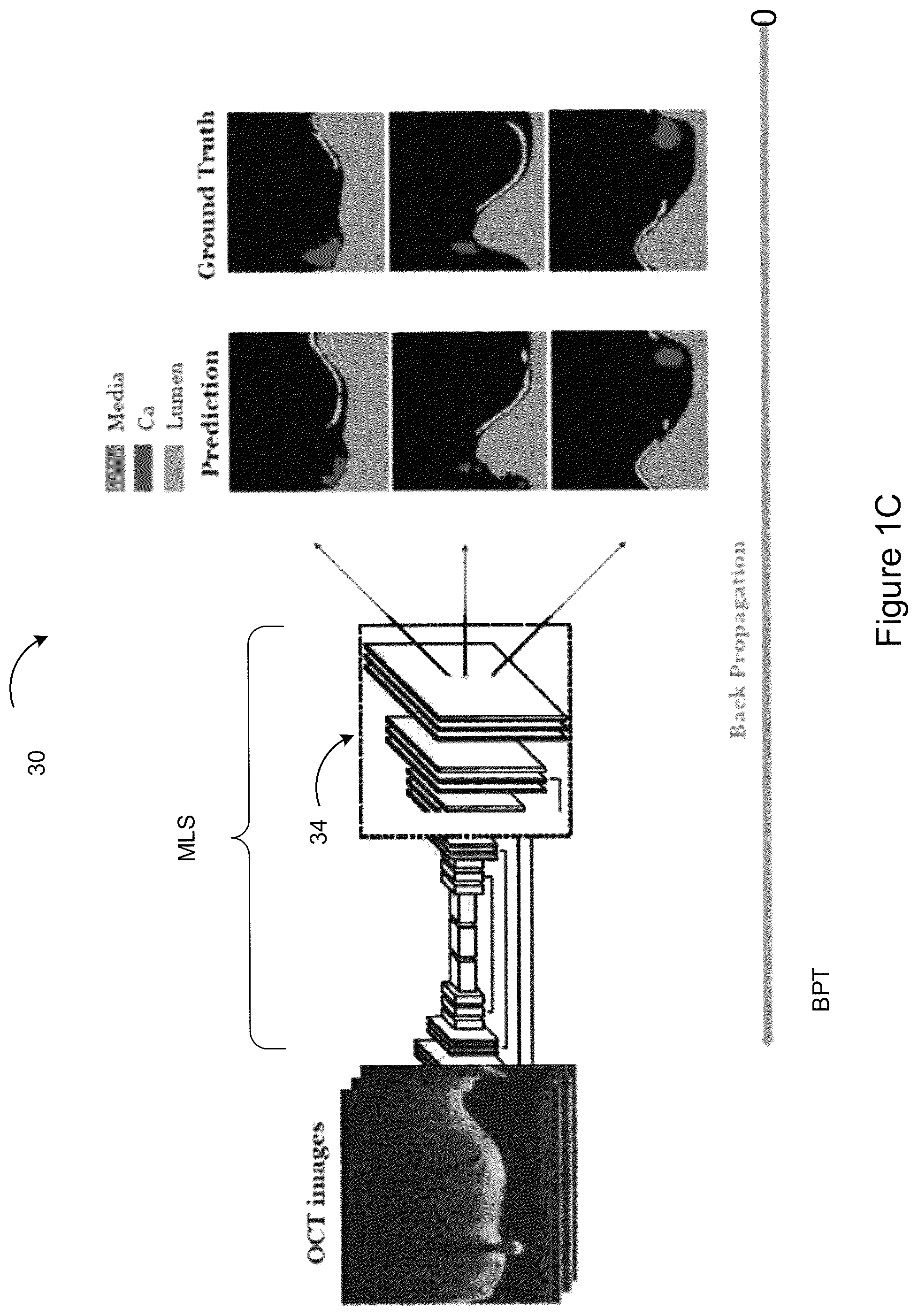 Patent US12327360 Figure 3 – Systems and methods for classification of arterial image regions and features thereof