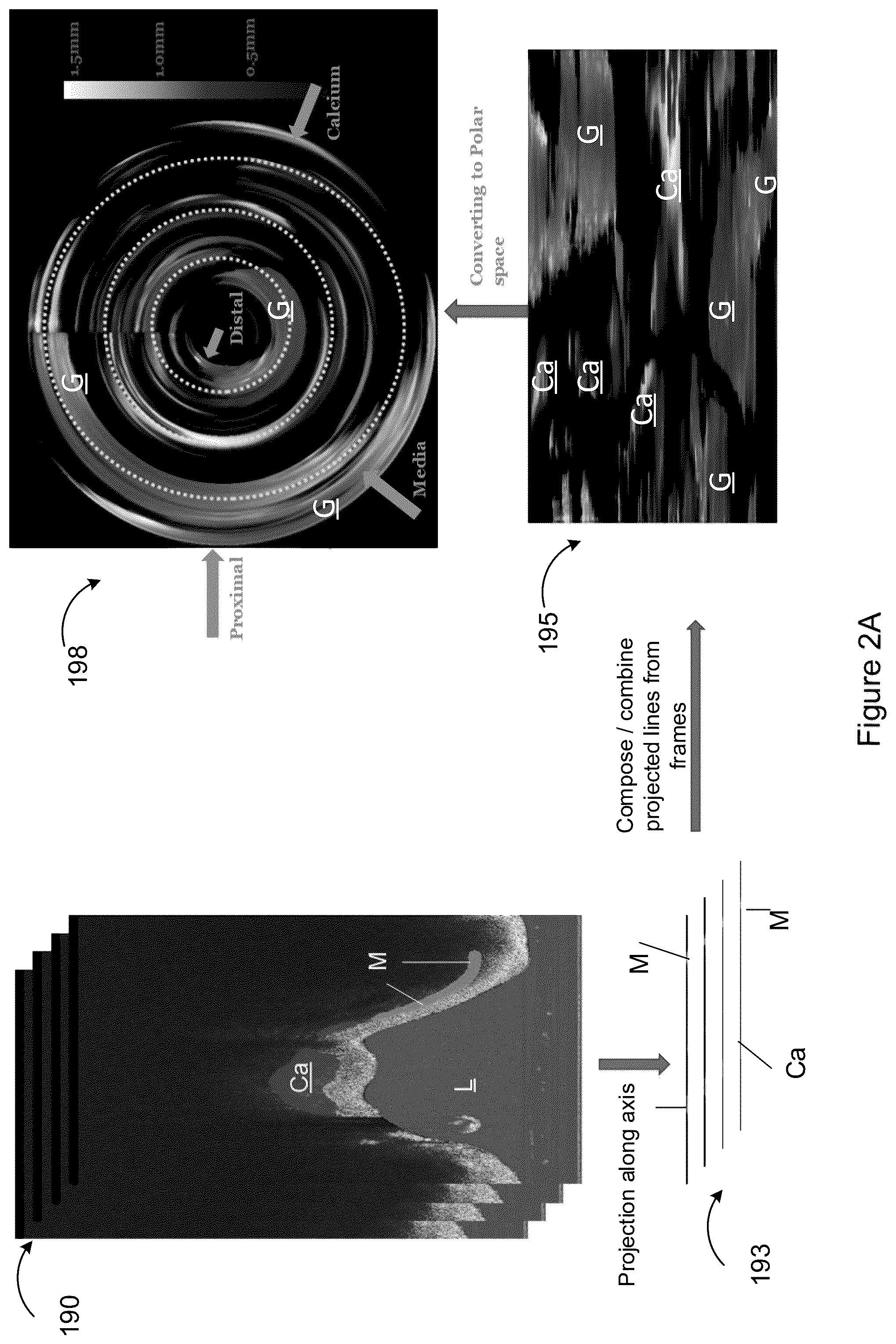 Patent US12327360 Figure 8 – Systems and methods for classification of arterial image regions and features thereof