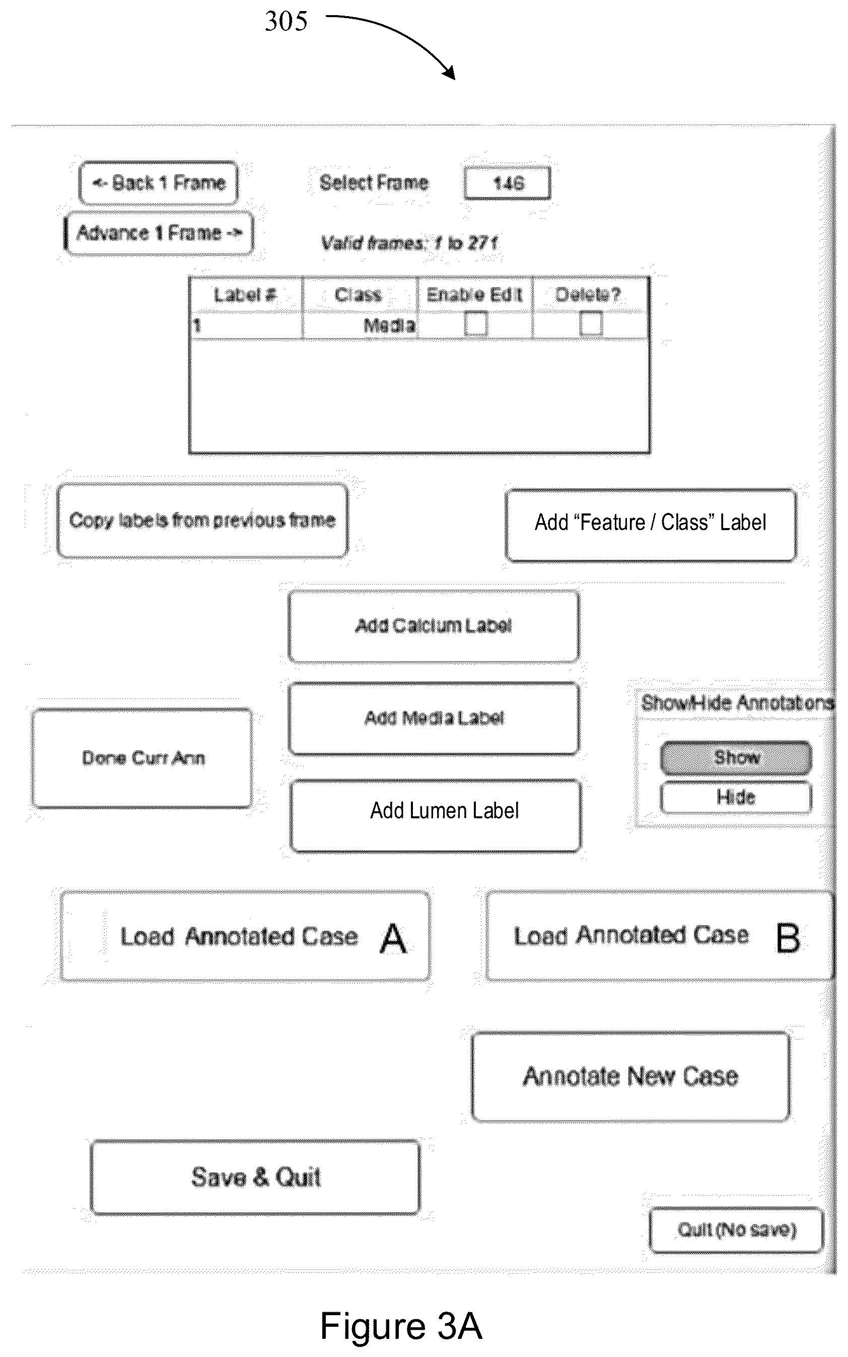 Patent US12327360 Figure 12 – Systems and methods for classification of arterial image regions and features thereof