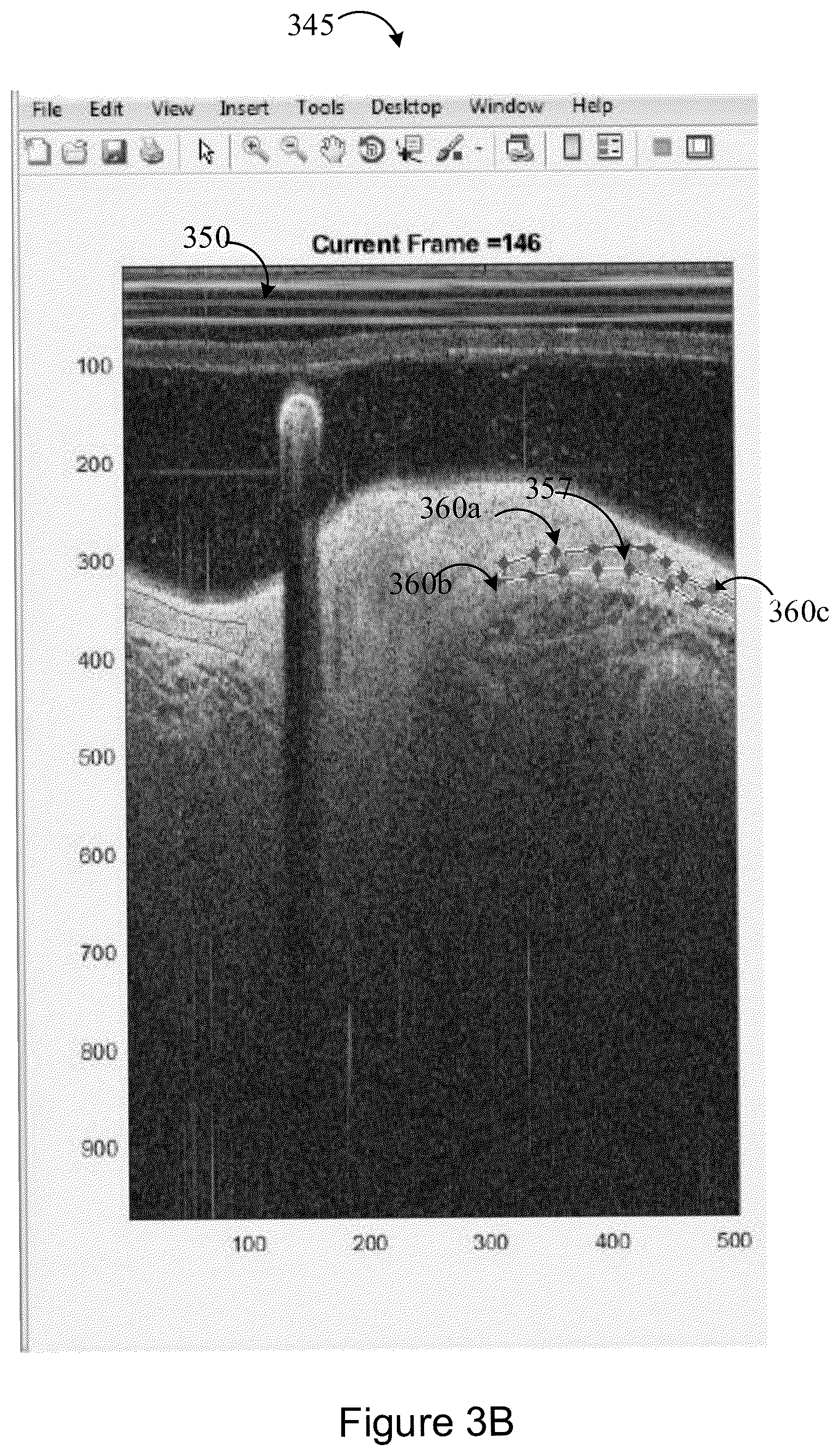 Patent US12327360 Figure 13 – Systems and methods for classification of arterial image regions and features thereof