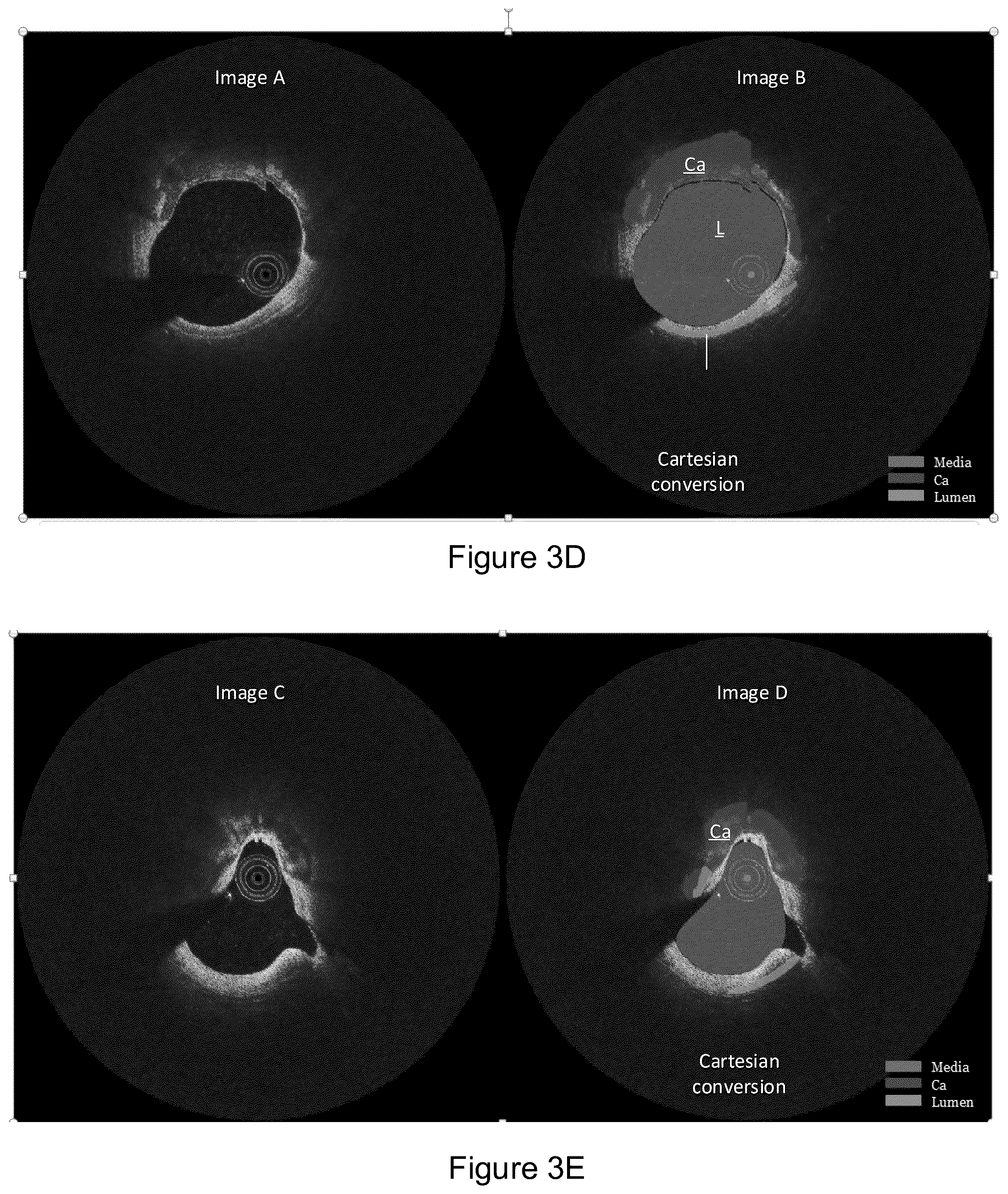 Patent US12327360 Figure 15 – Systems and methods for classification of arterial image regions and features thereof