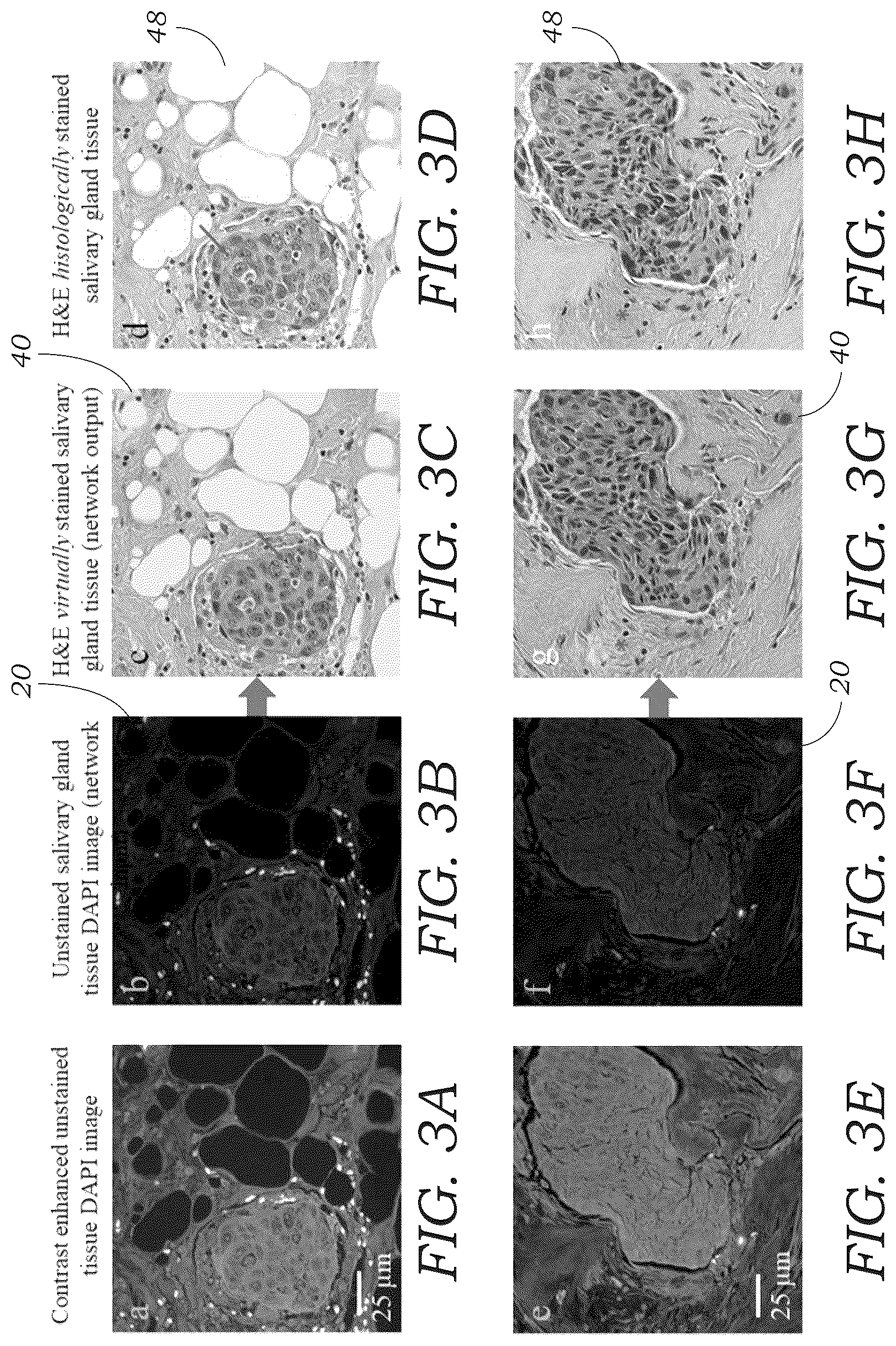 Patent US12327362 Figure 3 – Method and system for digital staining of label-free fluorescence images using deep learning