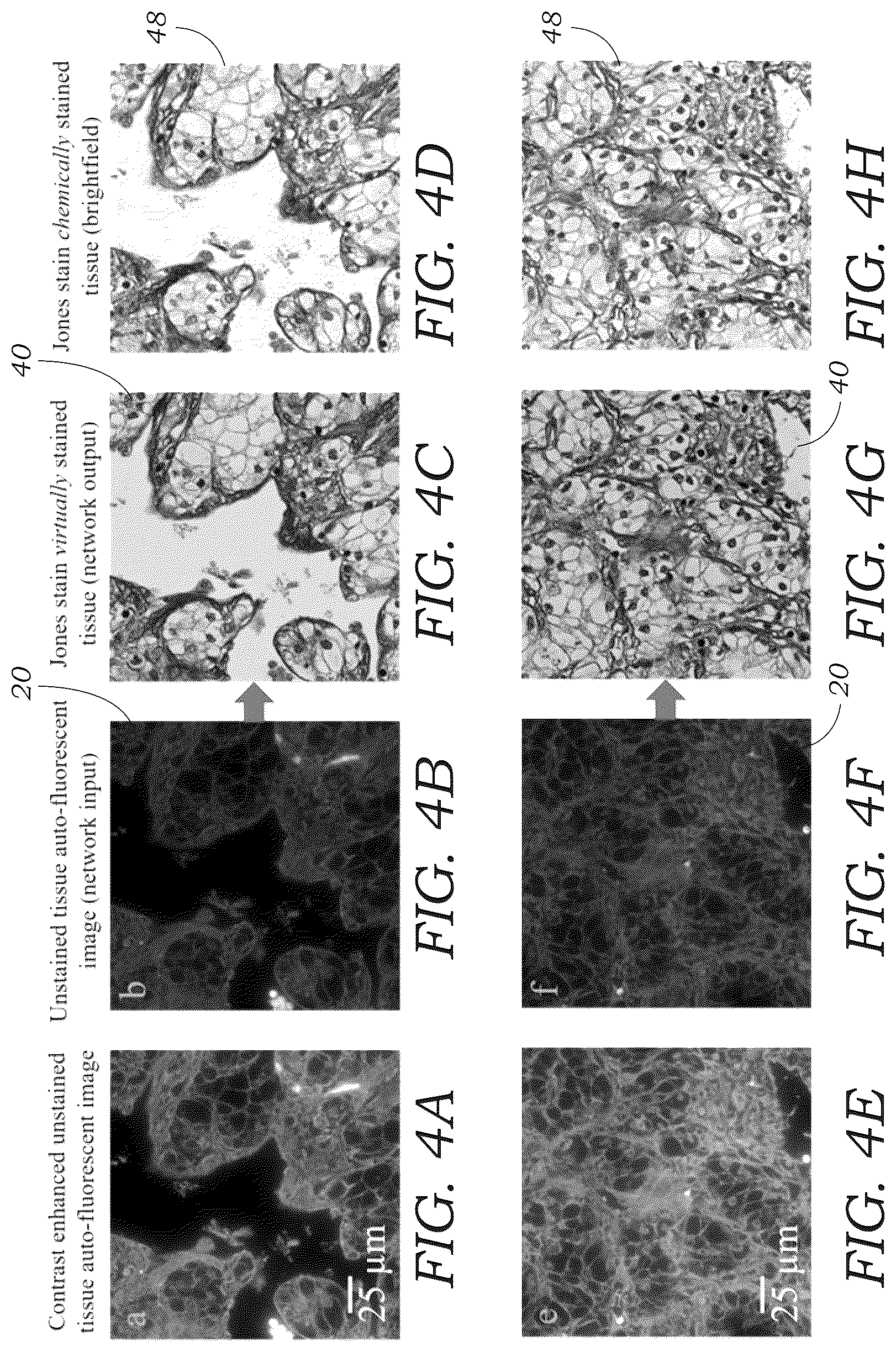 Patent US12327362 Figure 4 – Method and system for digital staining of label-free fluorescence images using deep learning