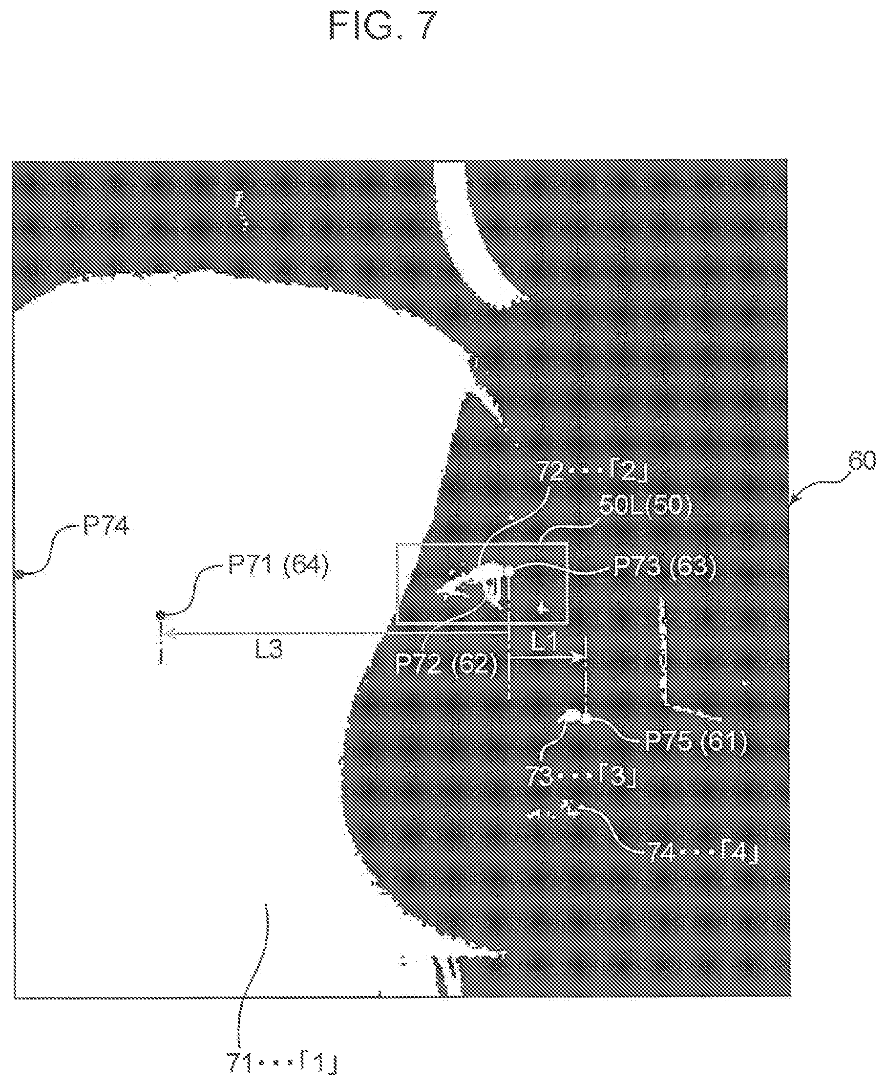 Patent US12327372 Figure 7 – Eye gaze detection method, eye gaze detection device, and non-transitory computer readable storage medium