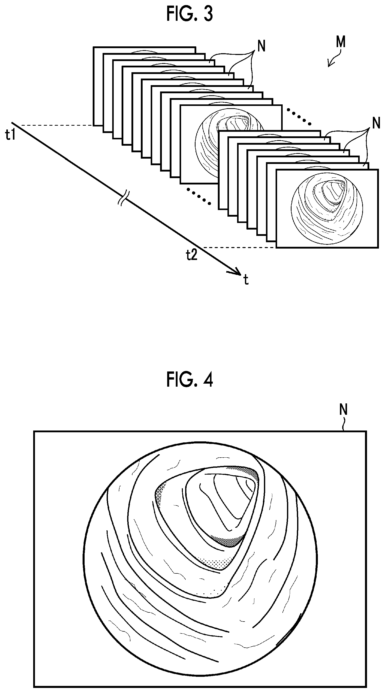 Patent US12327396 Figure 3 – Image processing device, image processing method, and program