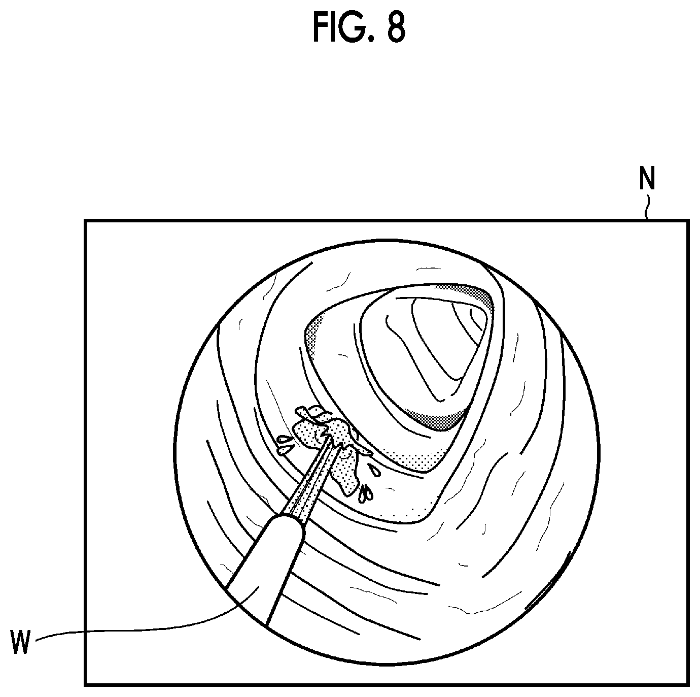 Patent US12327396 Figure 7 – Image processing device, image processing method, and program
