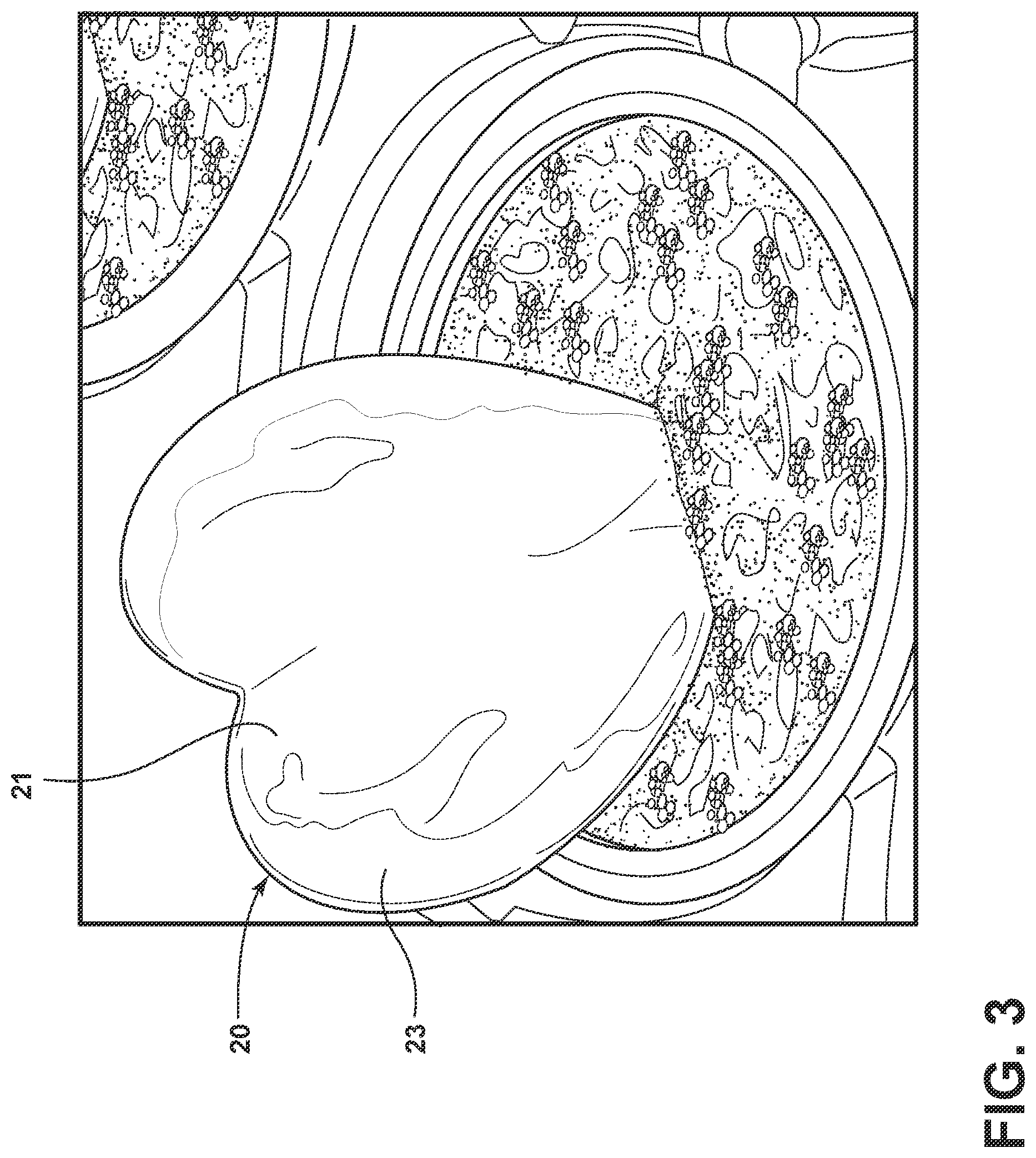 Patent US12327496 Figure 3 – Method of decoratively scarifying plant leaves