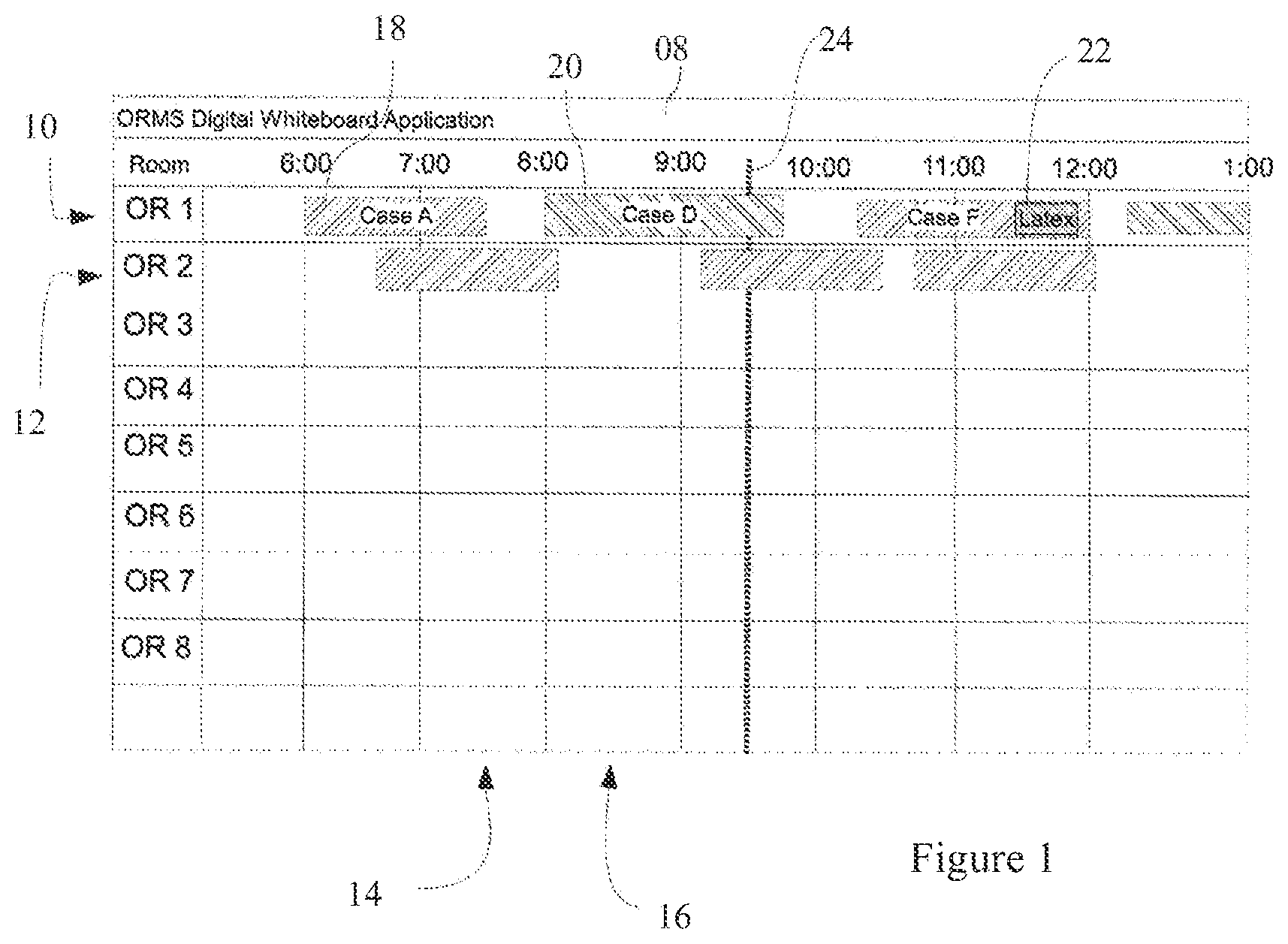 Patent US12327634 Figure 1 – Operating room management system with mobile application
