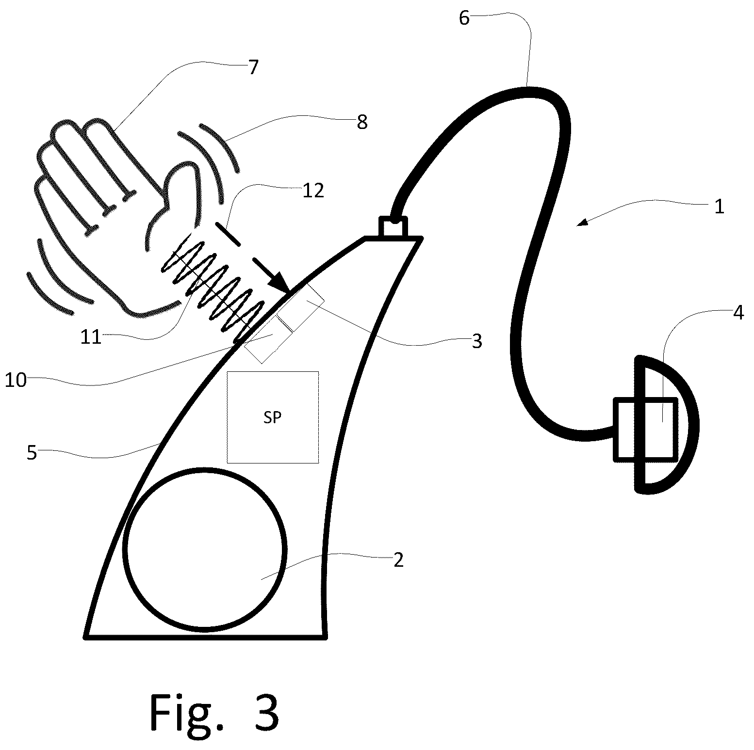 Patent US12328552 Figure 2 – Hearing aid with handsfree control
