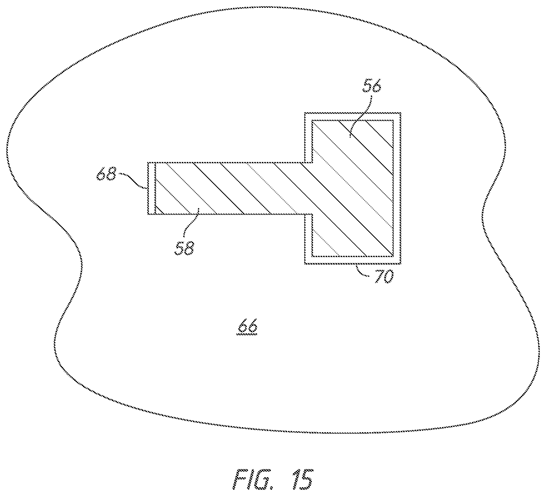 Patent US12332006 Figure 15 – Firearm magazine retention system with positive positioning feature