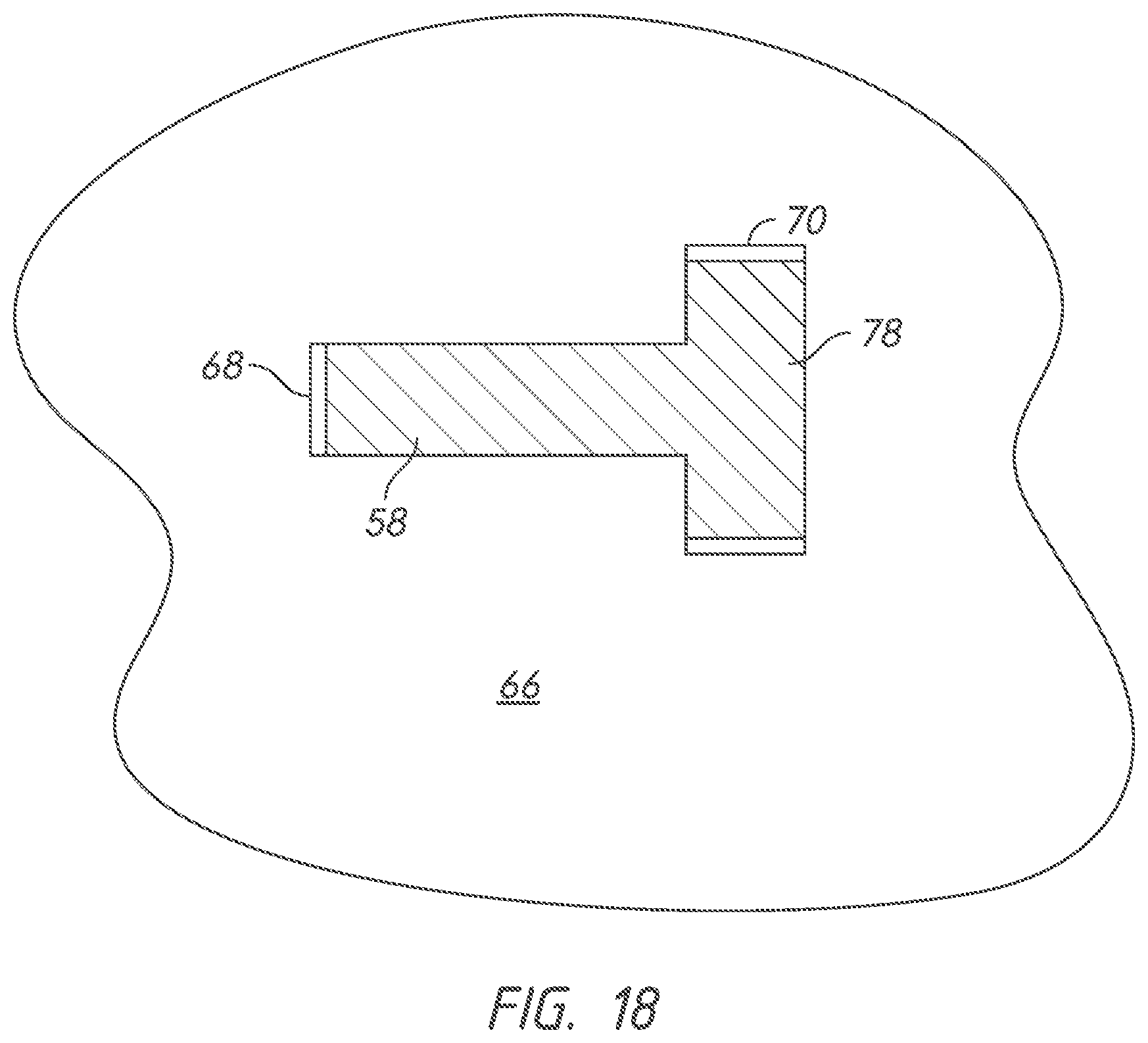 Patent US12332006 Figure 18 – Firearm magazine retention system with positive positioning feature