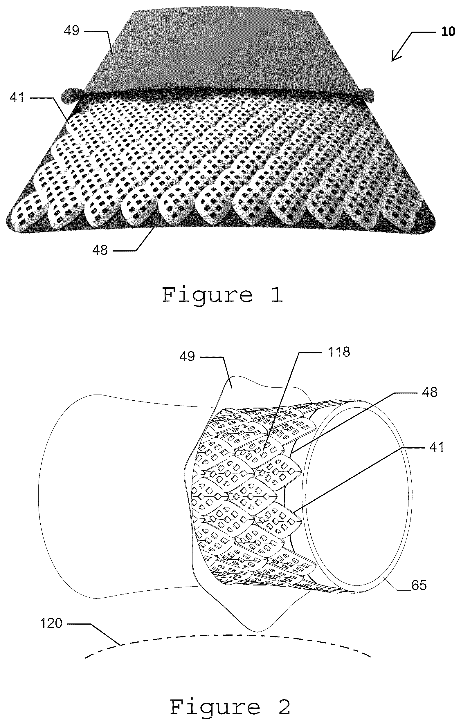 Patent US12332028 — Composite material — Figure 1