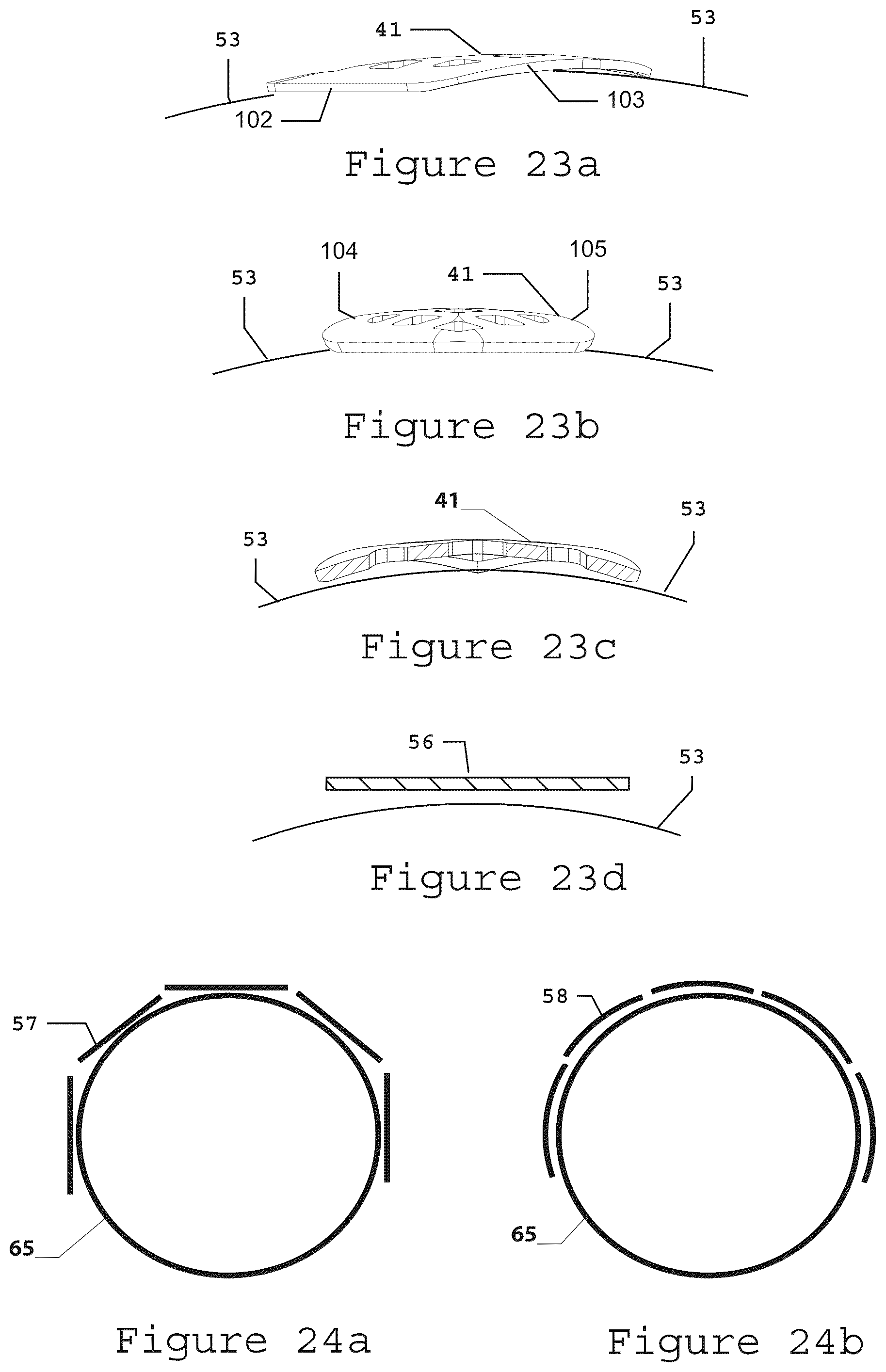 Patent US12332028 Figure 17 – Composite material