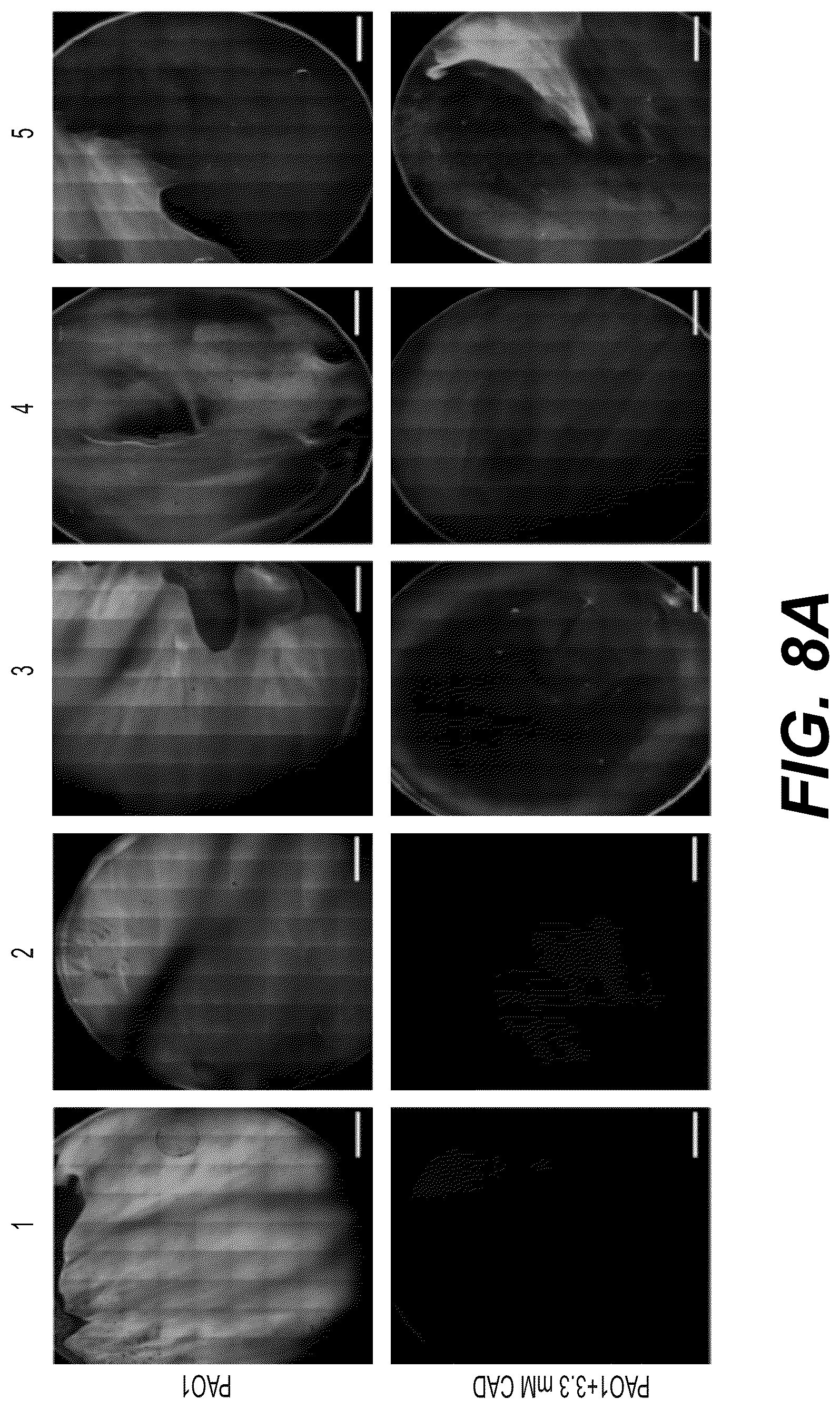 Patent US12332198 Figure 13 – Metabolite based diagnostics for periprosthetic joint infection