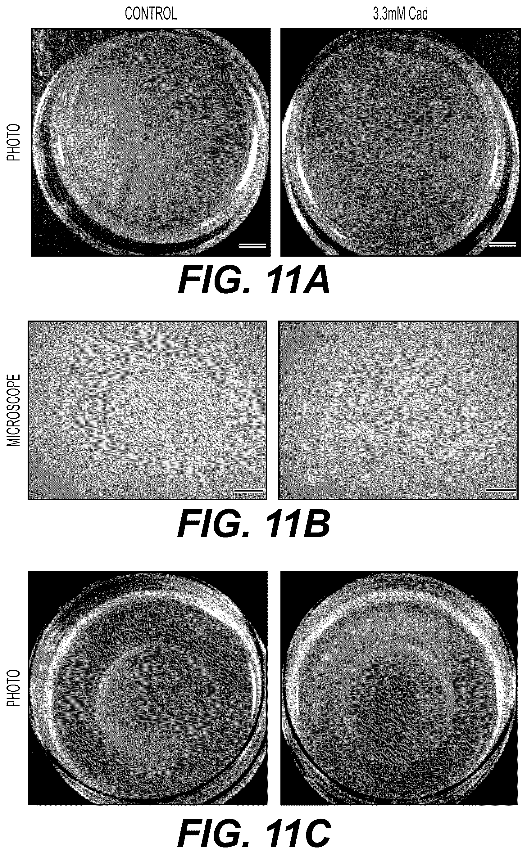 Patent US12332198 Figure 17 – Metabolite based diagnostics for periprosthetic joint infection
