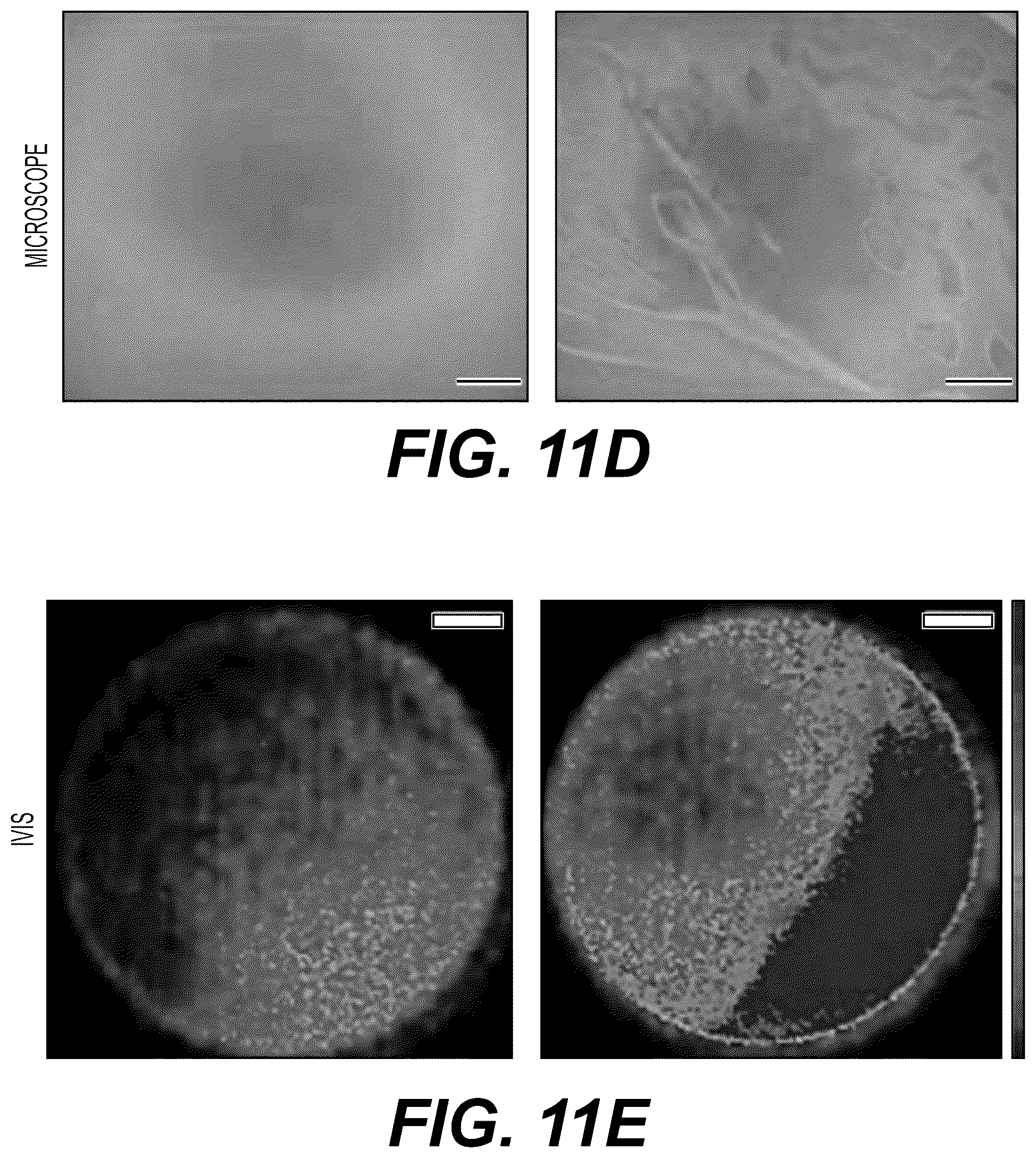Patent US12332198 Figure 18 – Metabolite based diagnostics for periprosthetic joint infection
