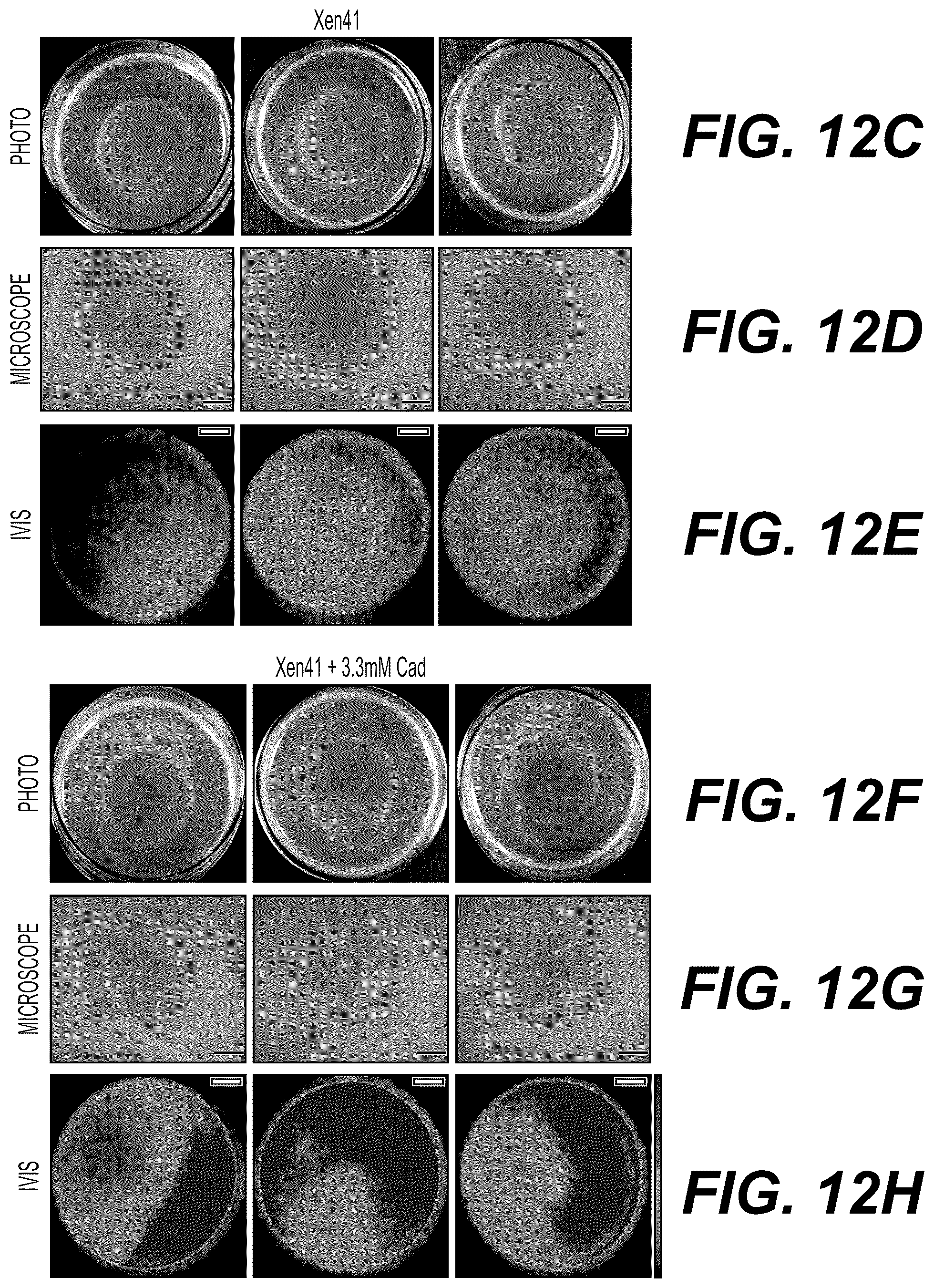 Patent US12332198 Figure 20 – Metabolite based diagnostics for periprosthetic joint infection