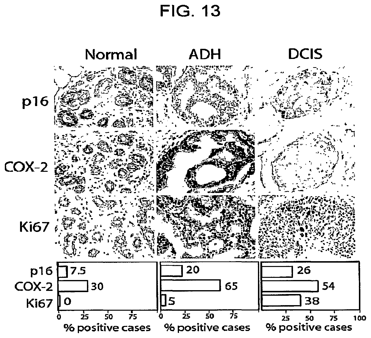 Patent US12332245 Figure 13 – Cancer biomarkers and methods of use thereof
