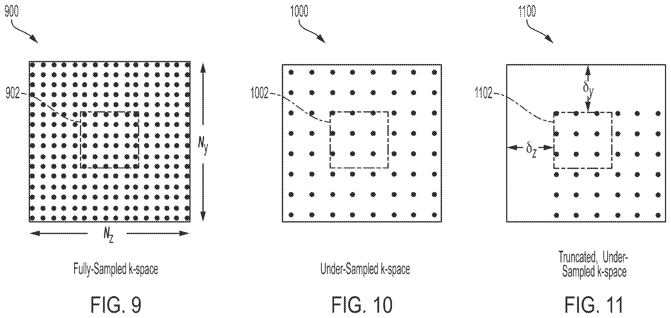 Patent US12332333 Figure 8 – Accelerating magnetic resonance imaging using parallel imaging and iterative image reconstruction