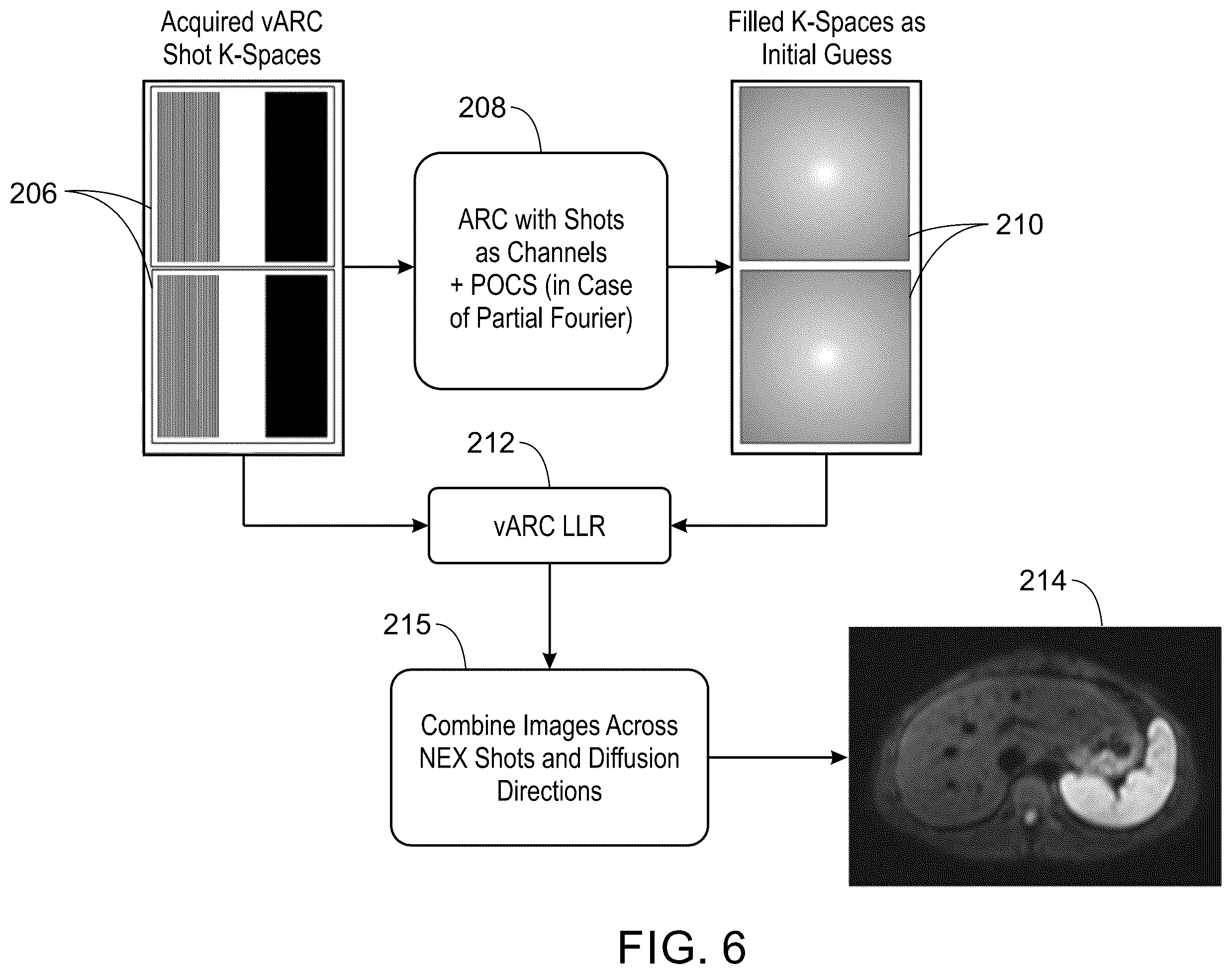 Patent US12332334 Figure 4 – System and method for multi-shot variable auto-calibrating reconstruction for single channel diffusion weighted magnetic resonance imaging using low rank