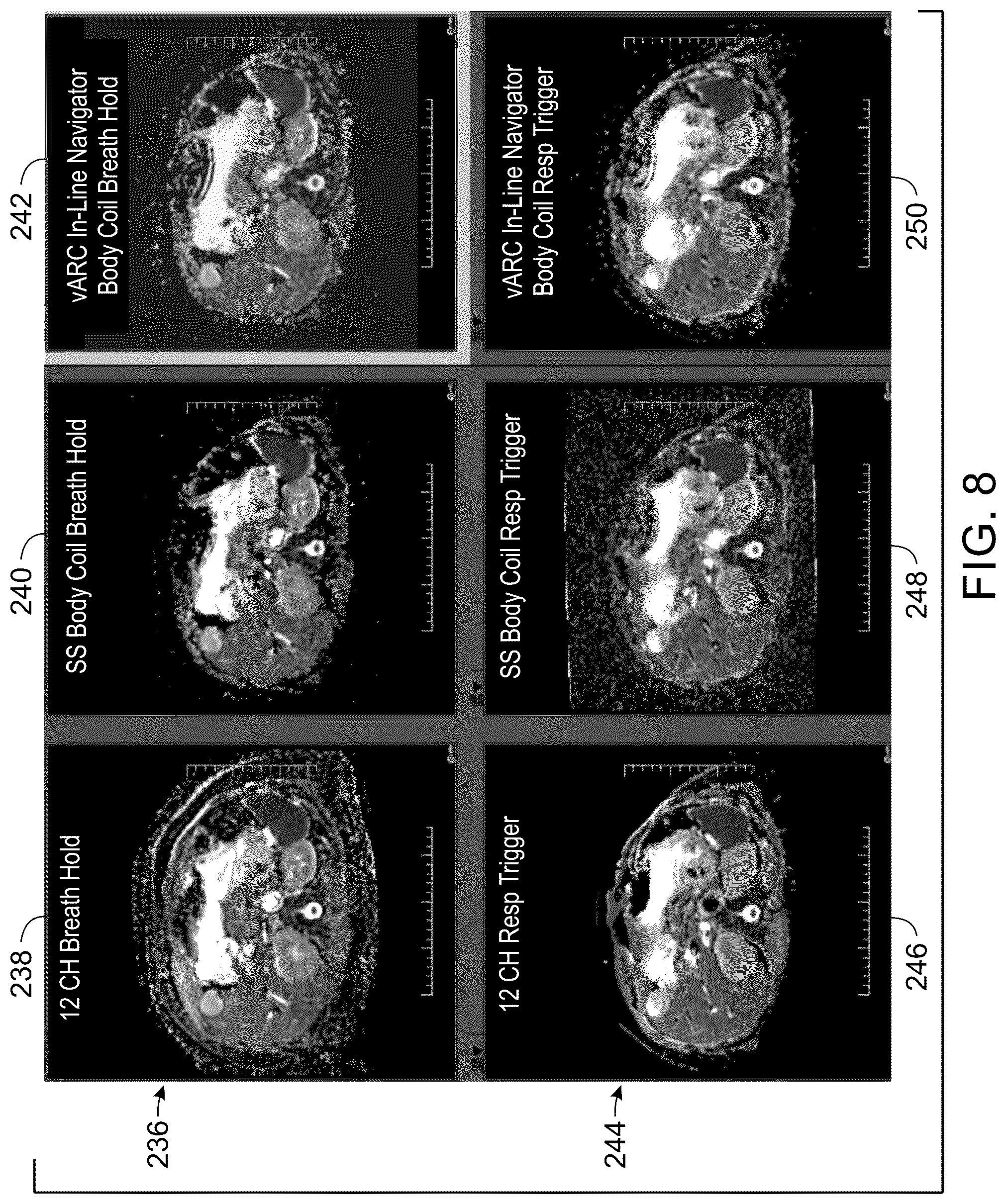 Patent US12332334 Figure 6 – System and method for multi-shot variable auto-calibrating reconstruction for single channel diffusion weighted magnetic resonance imaging using low rank