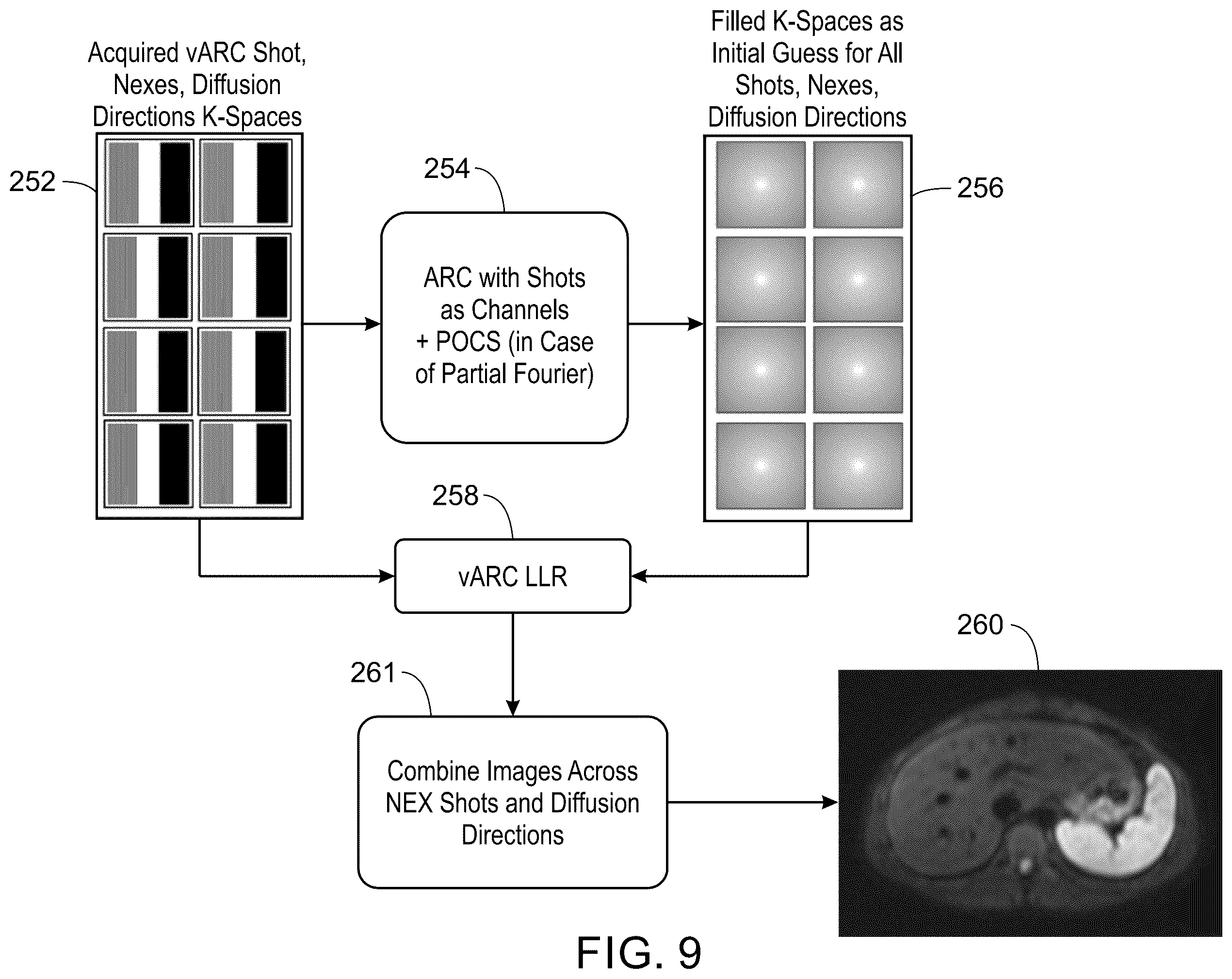 Patent US12332334 Figure 7 – System and method for multi-shot variable auto-calibrating reconstruction for single channel diffusion weighted magnetic resonance imaging using low rank
