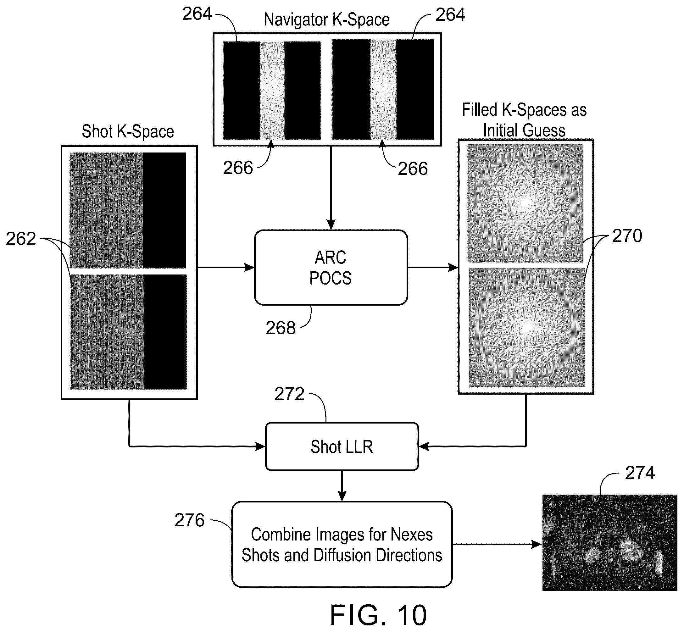 Patent US12332334 Figure 8 – System and method for multi-shot variable auto-calibrating reconstruction for single channel diffusion weighted magnetic resonance imaging using low rank