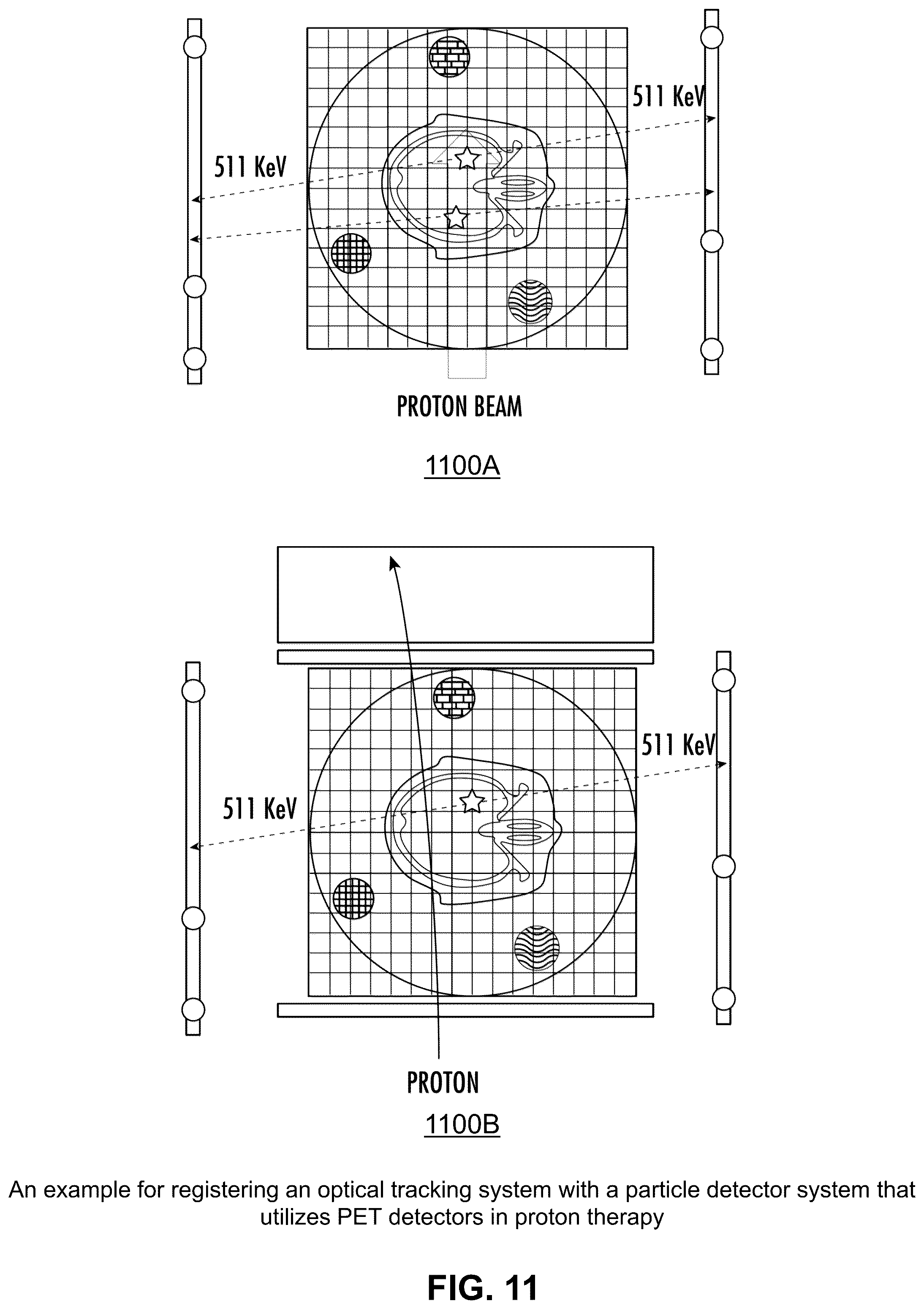 Patent US12332393 Figure 11 – Method to register an optical tracking system with a particle detector system