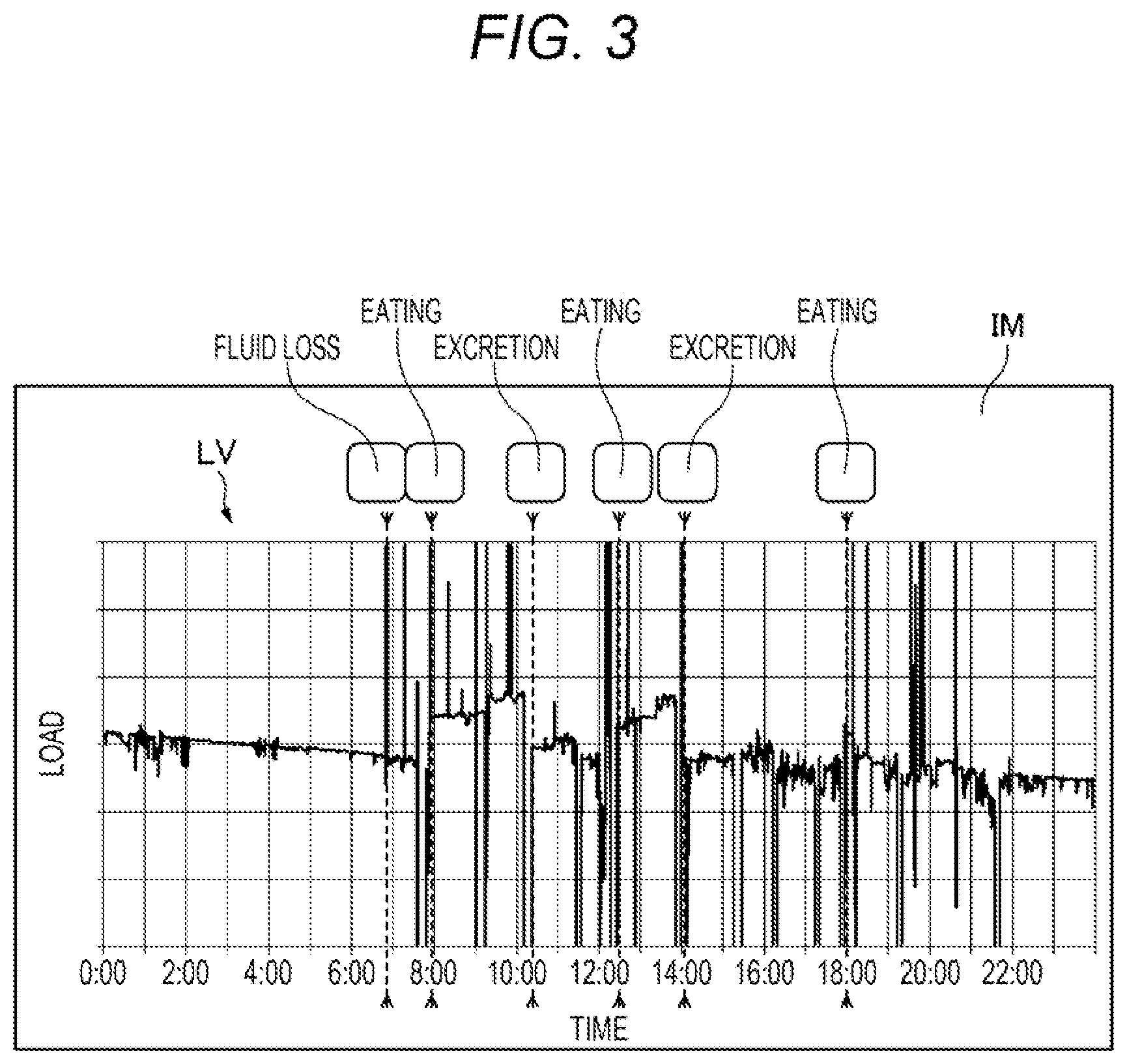 Patent US12332616 Figure 3 – Fluid balance management system, prediction device, learned model generation device, and learned model generation method