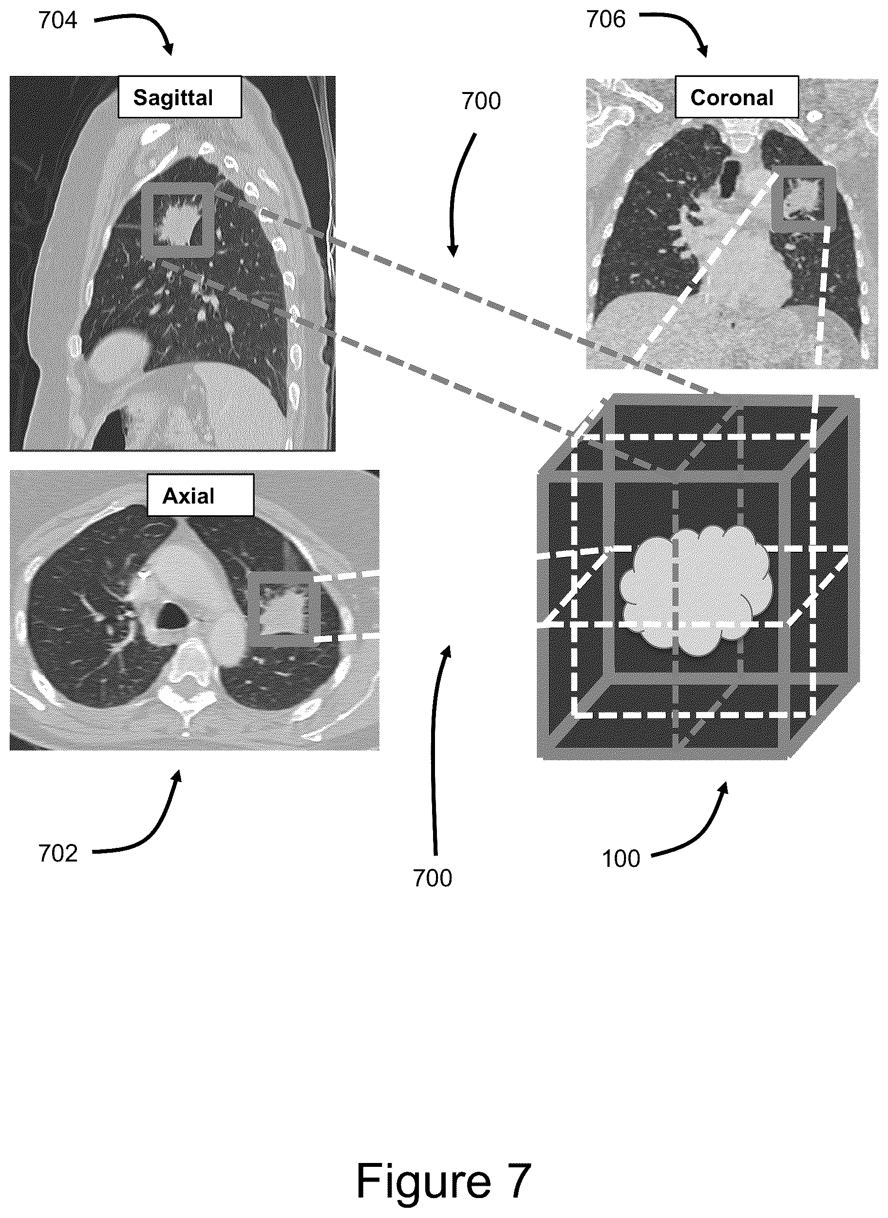 Patent US12333087 Figure 7 – Interactive 3D cursor