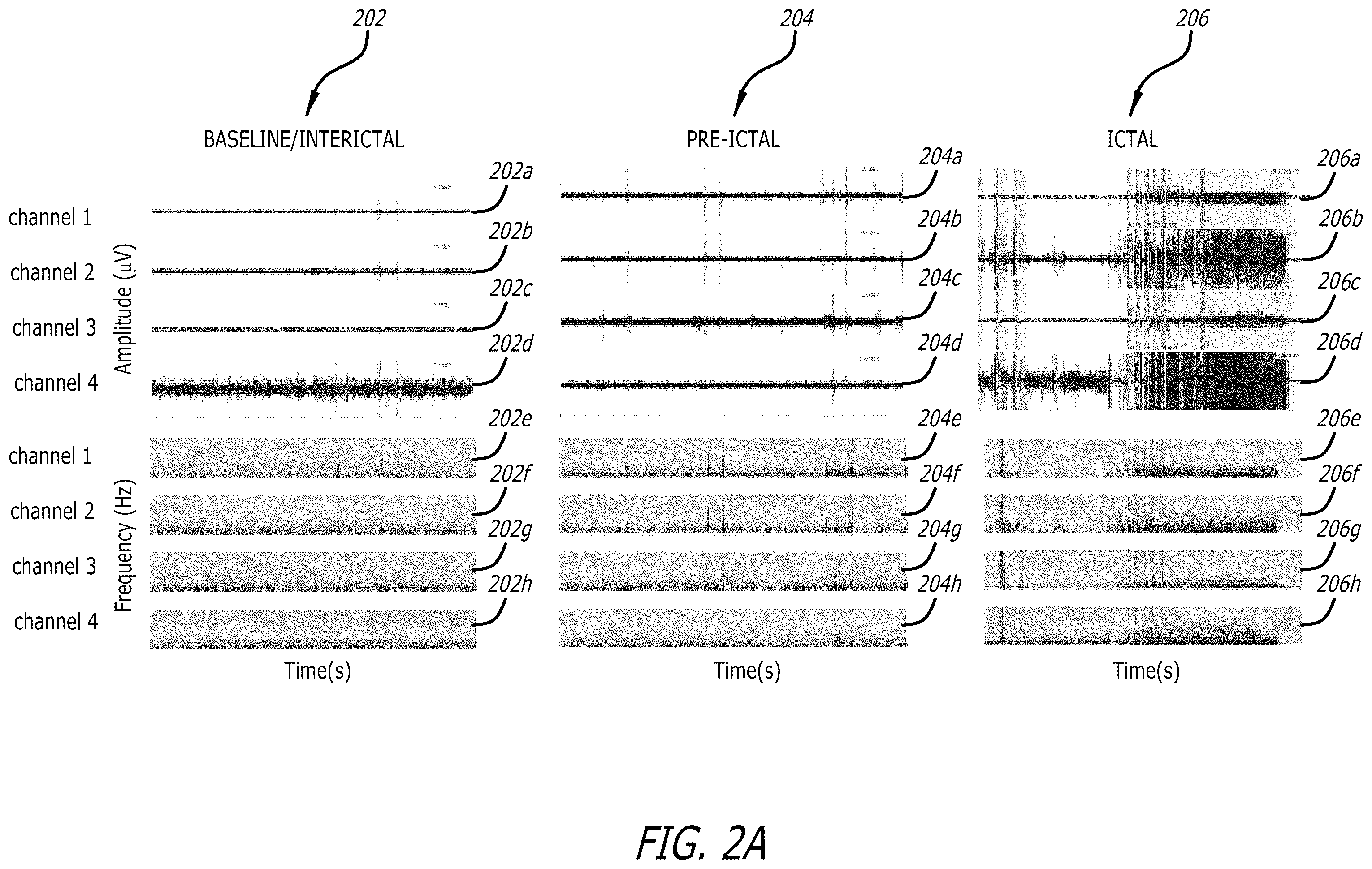 Patent US12333443 Figure 2 – Systems and methods for using federated learning for training centralized seizure detection and prediction models on decentralized datasets