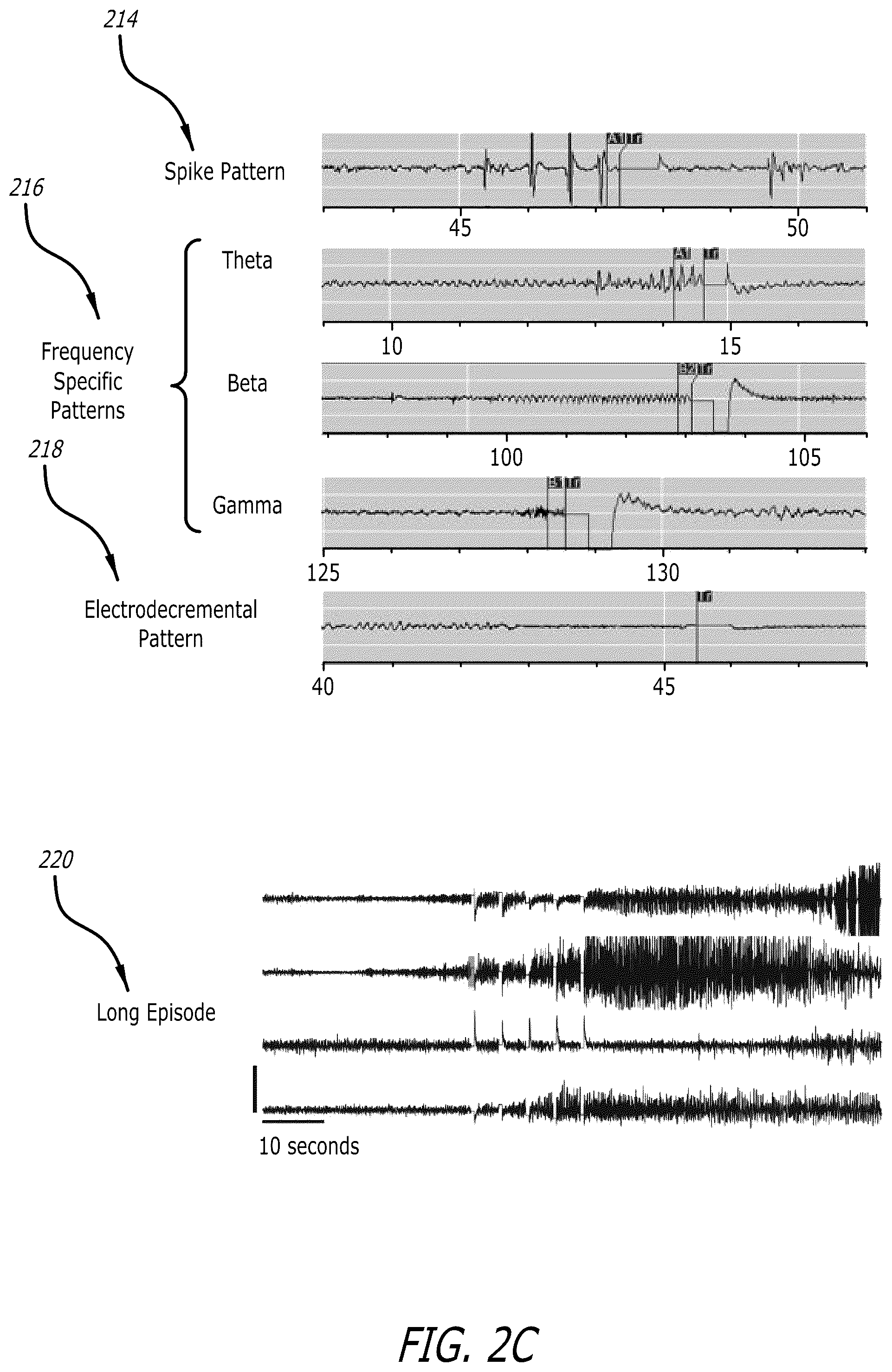 Patent US12333443 Figure 4 – Systems and methods for using federated learning for training centralized seizure detection and prediction models on decentralized datasets