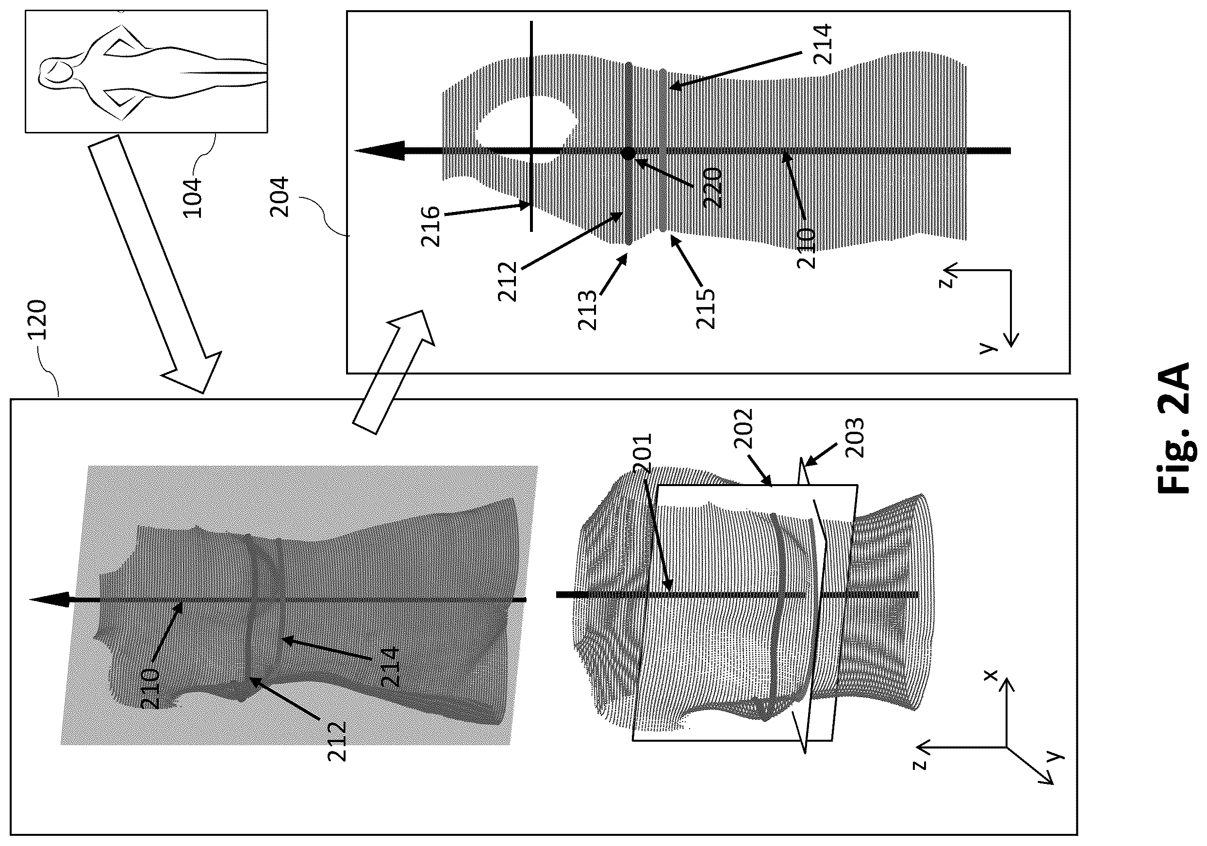 Patent US12333595 Figure 4 – Optimizing bra sizing according to the 3D shape of breasts