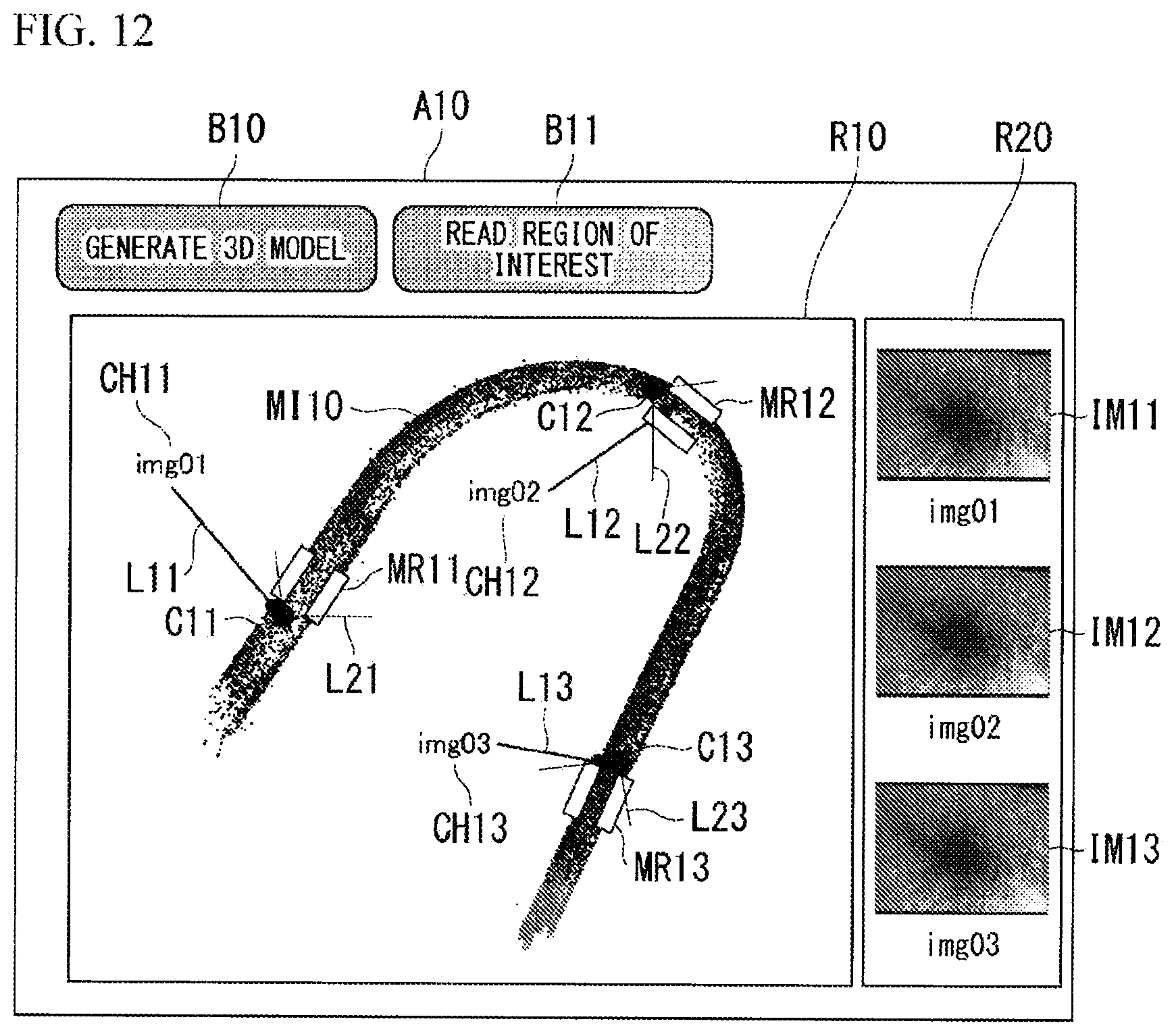 Patent US12333644 Figure 12 – Image display method, display control device, and recording medium for displaying shape image of subject and coordinates estimated from two-dimensional coordinates in reference image projected thereon